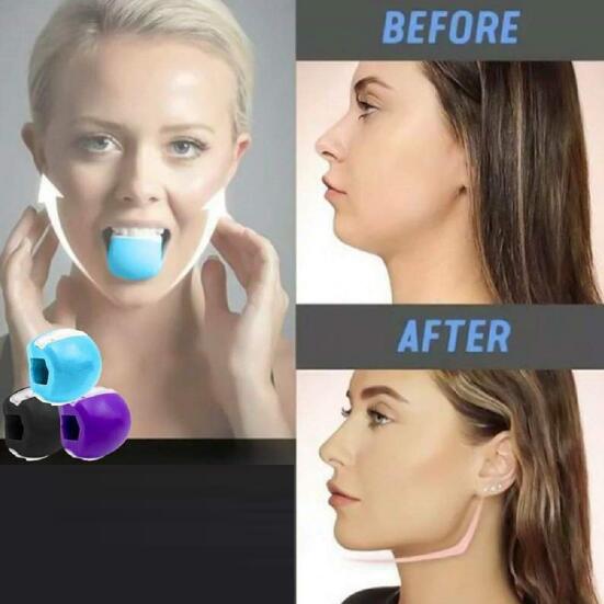 Side-by-side before and after woman’s profile showing sharper jawline and reduced double chin after consistent use