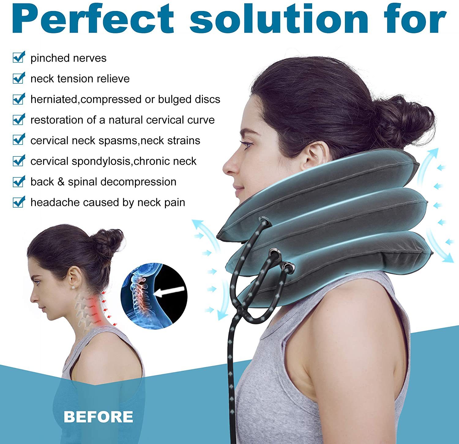 Infographic illustrating eight chronic neck conditions including pinched nerves, herniated discs, and cervical spondylosis