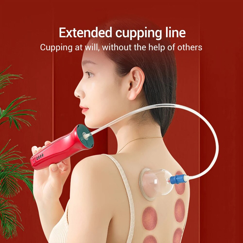 Woman demonstrating extended cupping device reaching her back independently with extended tubing