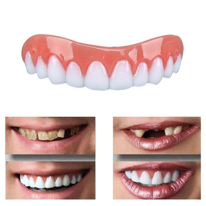 Front-facing upper veneer set showing tooth-by-tooth detail and ergonomic arch