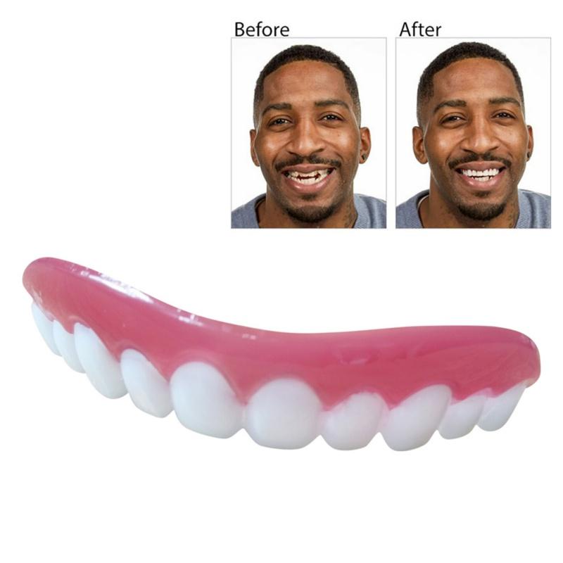 Before/after comparison showing yellowed, crooked teeth transformed into bright aligned smile