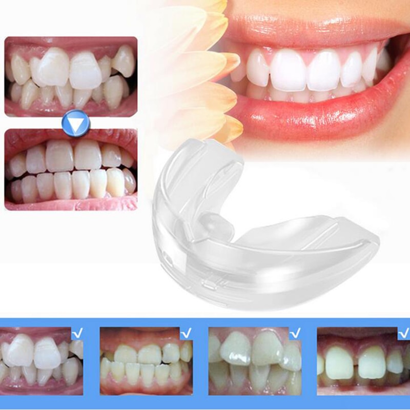 Three clear thermoplastic aligners in progressive stages, soft backlit glow on honey-oak wood