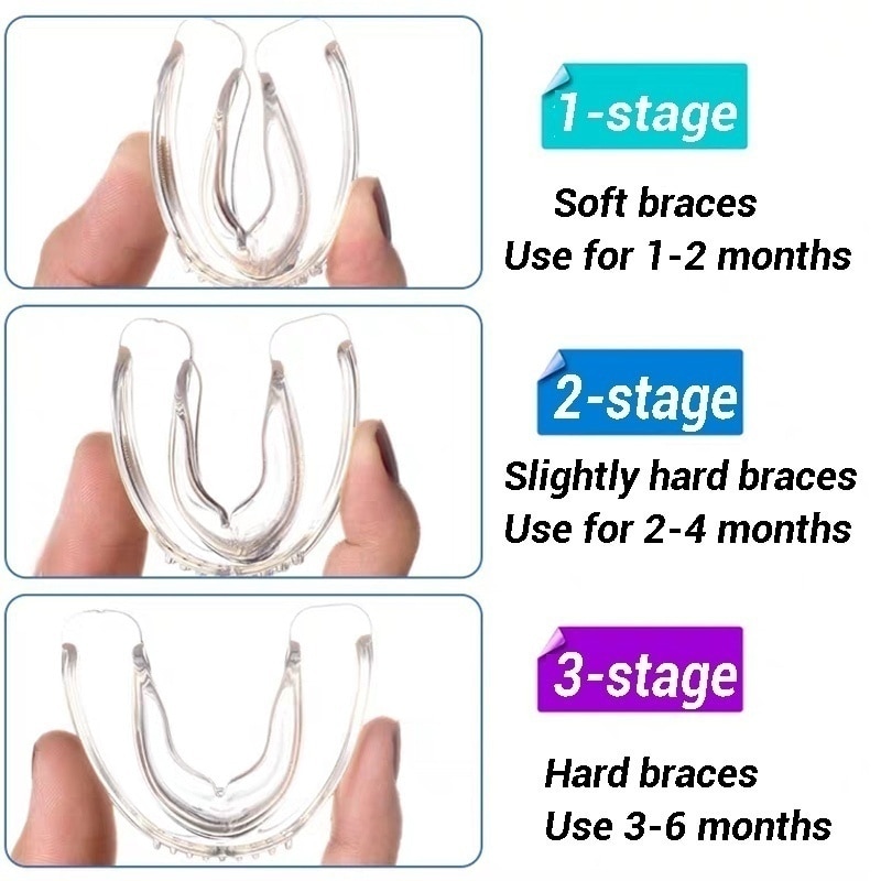 Annotated technical diagram labeling tooth arch track, tongue block, and tongue blocking features with callout points