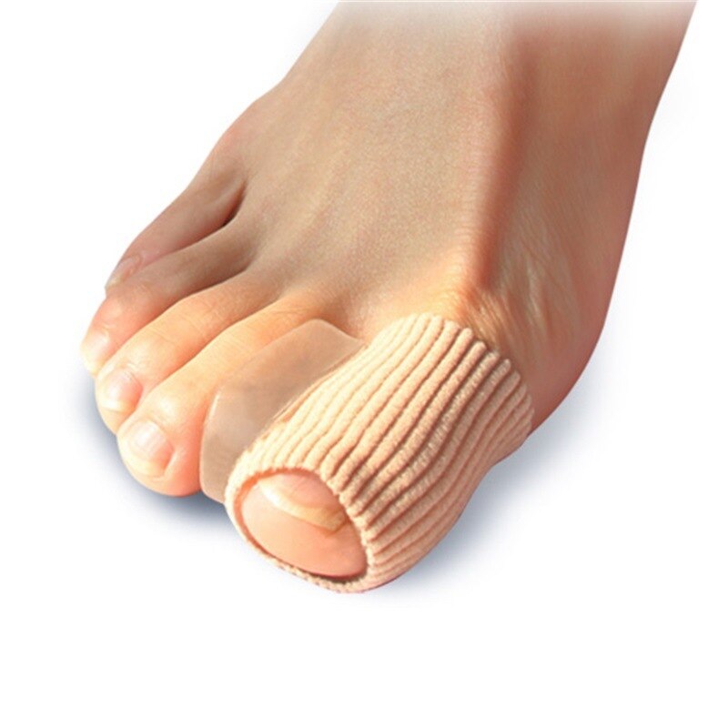 Single foot before correction, illustrating discomfort and misalignment