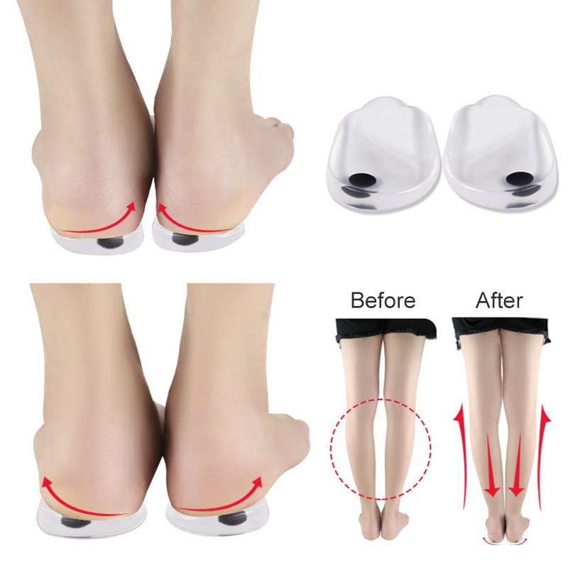 Foot positioning diagram with red arrow indicators showing inward and outward pull for leg alignment correction