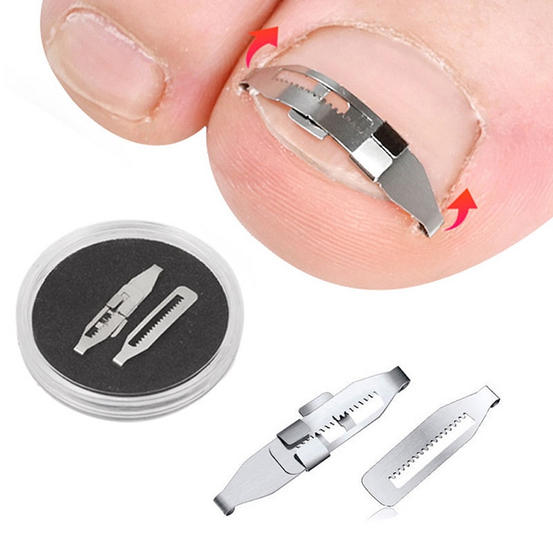 OrthoFix Pro - tool for correcting ingrown toenails-1.jpg