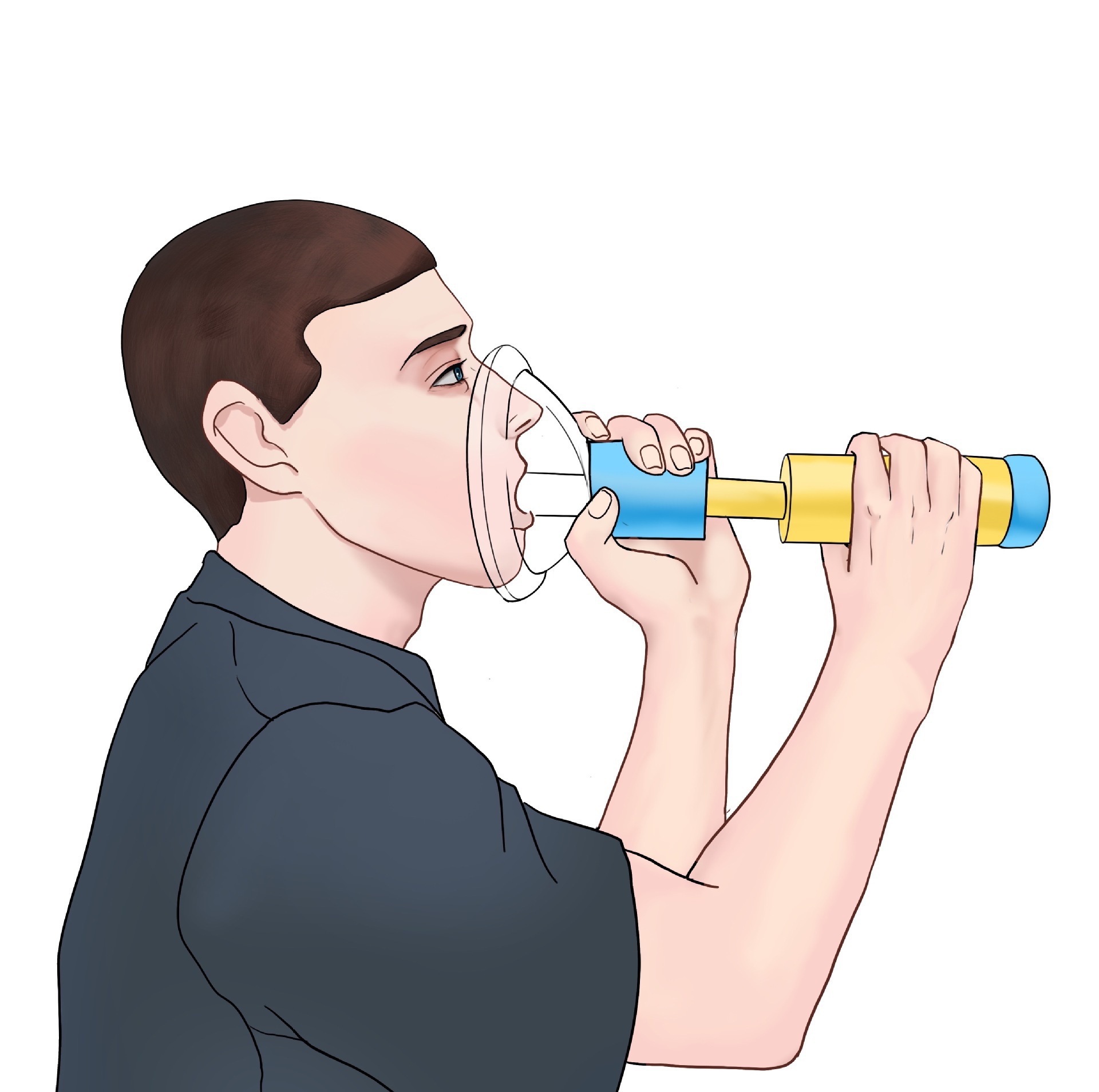 Hand gripping textured yellow cylindrical tube with extended nozzle during use on choking victim