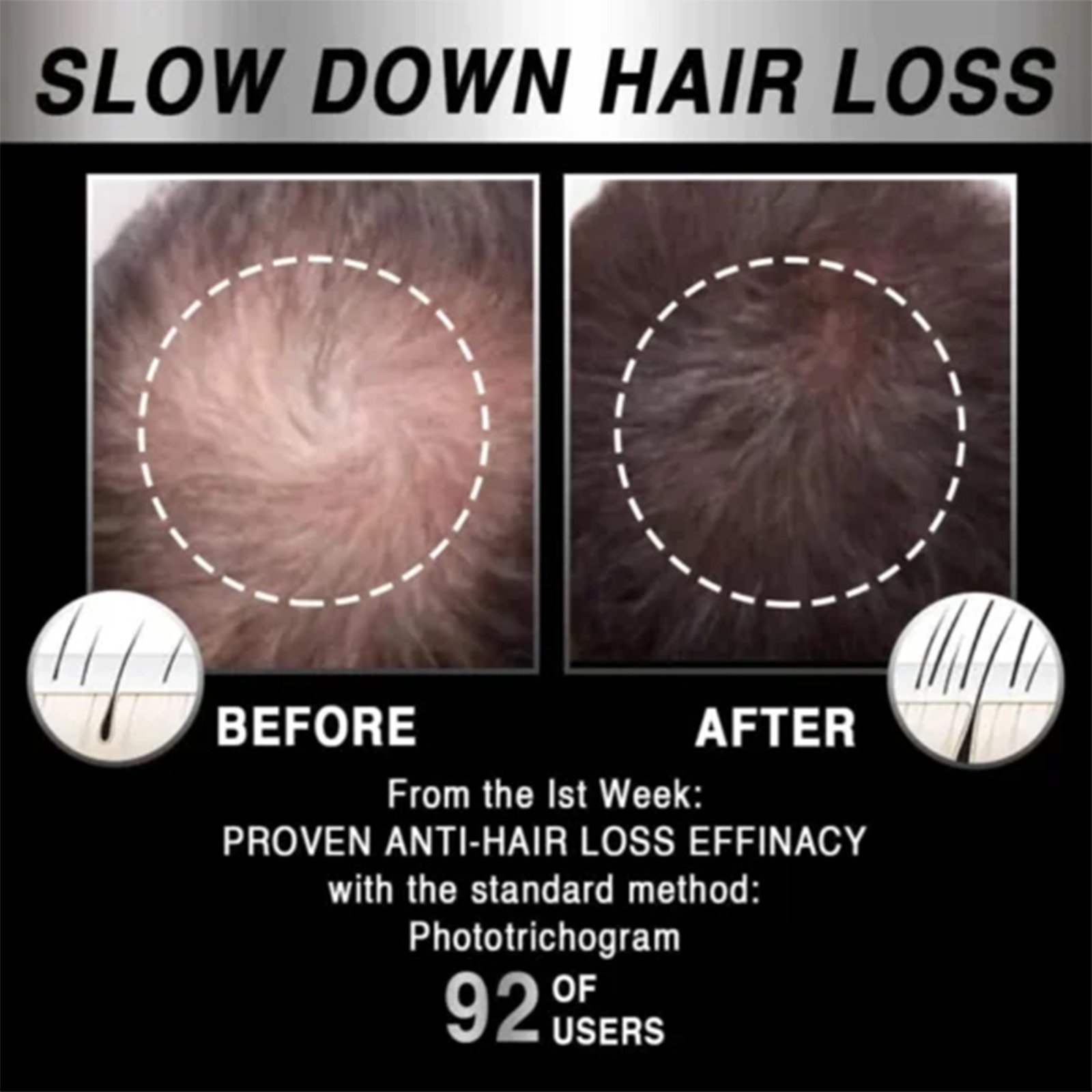 Illustrative before and after crown scalp comparison