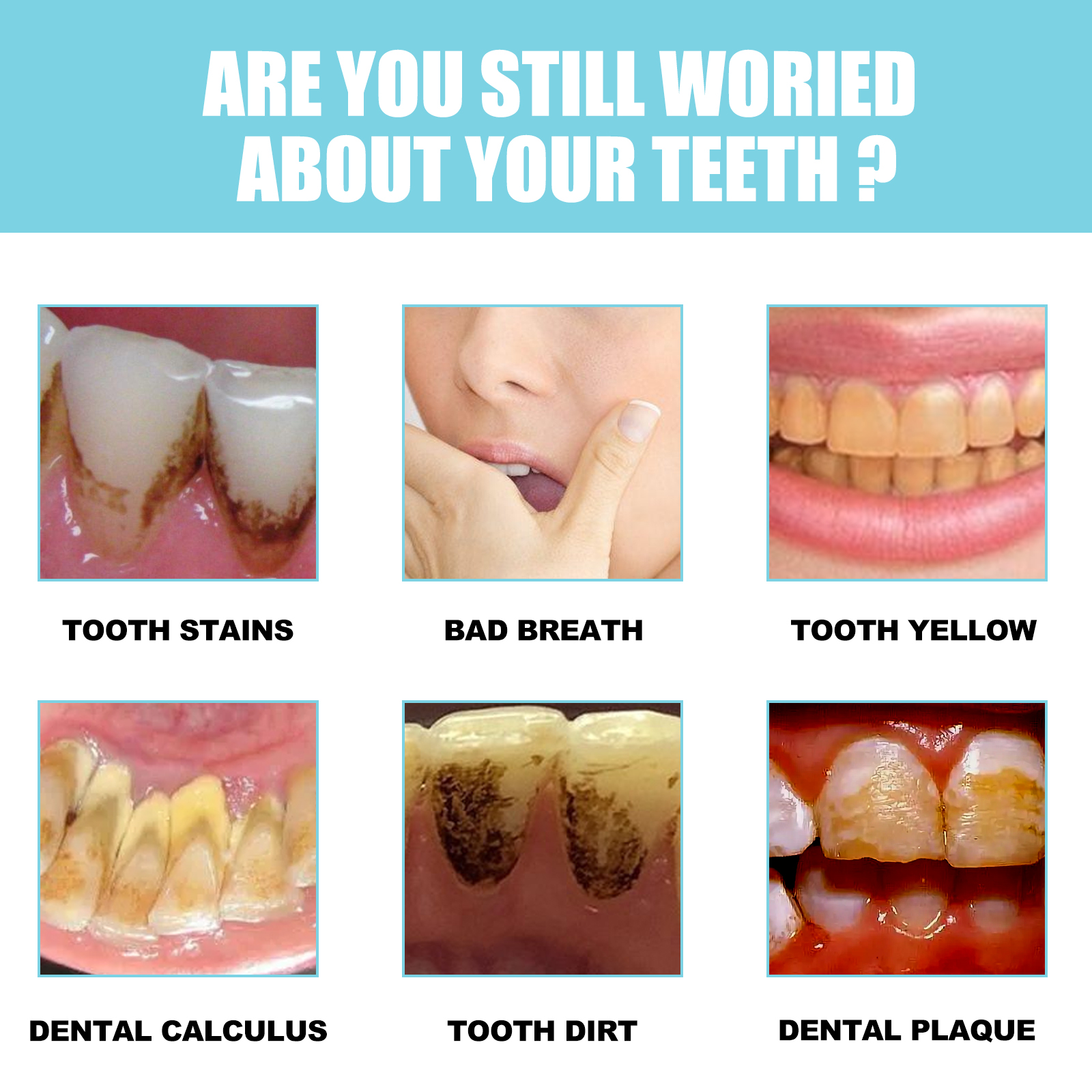 Oral-care concerns including stains yellowing and bad breath