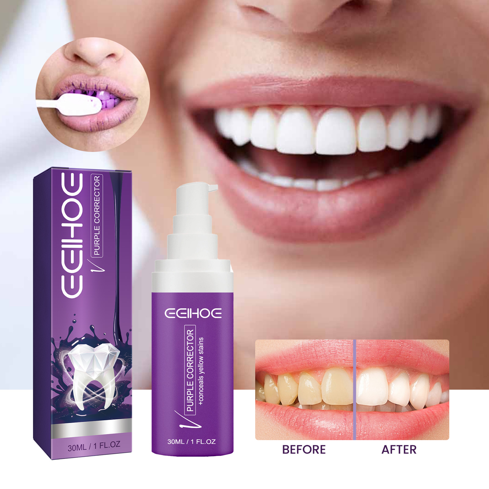 Purple corrector beside illustrative brighter smile