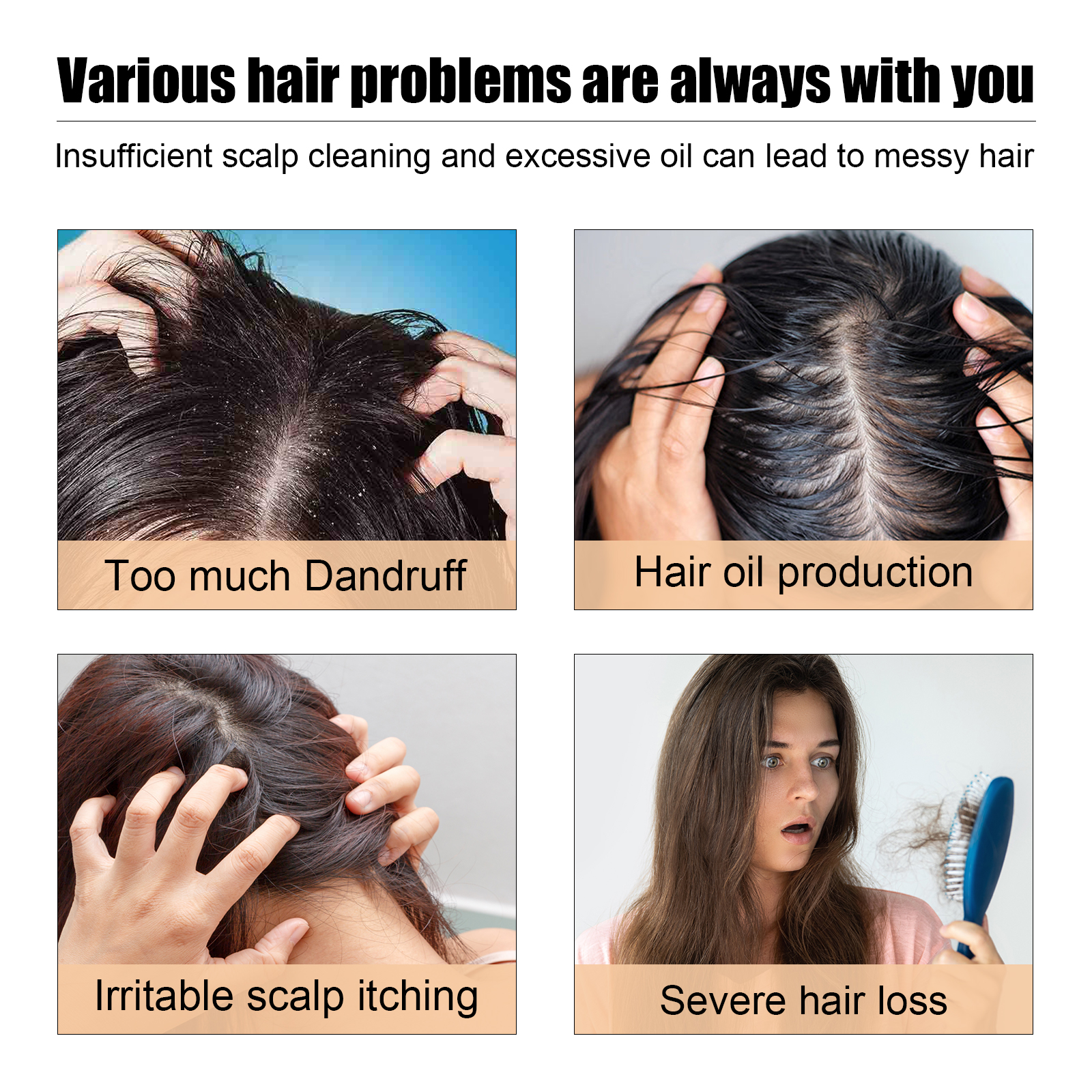 Graphic showing oily flaky itchy scalp and hair concerns