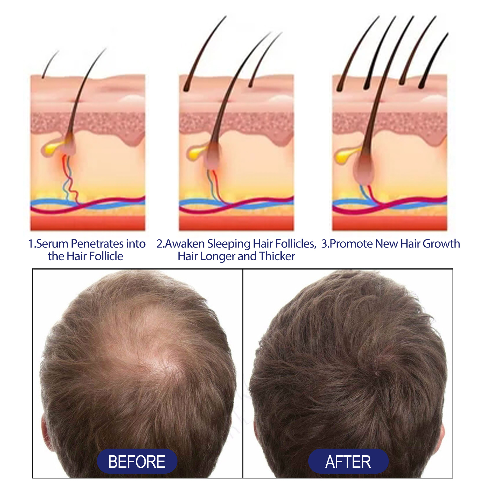 East Moon scalp treatment applicator close-up