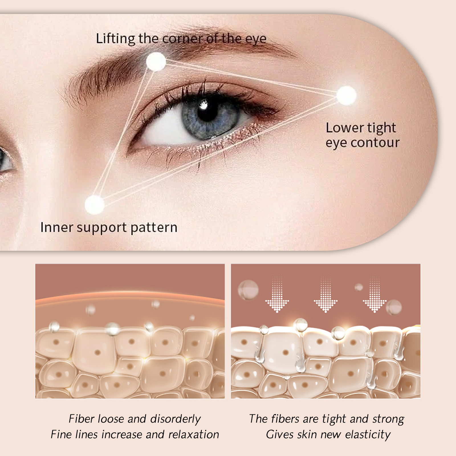 Diagram showing lifted eye corner and lower contour support