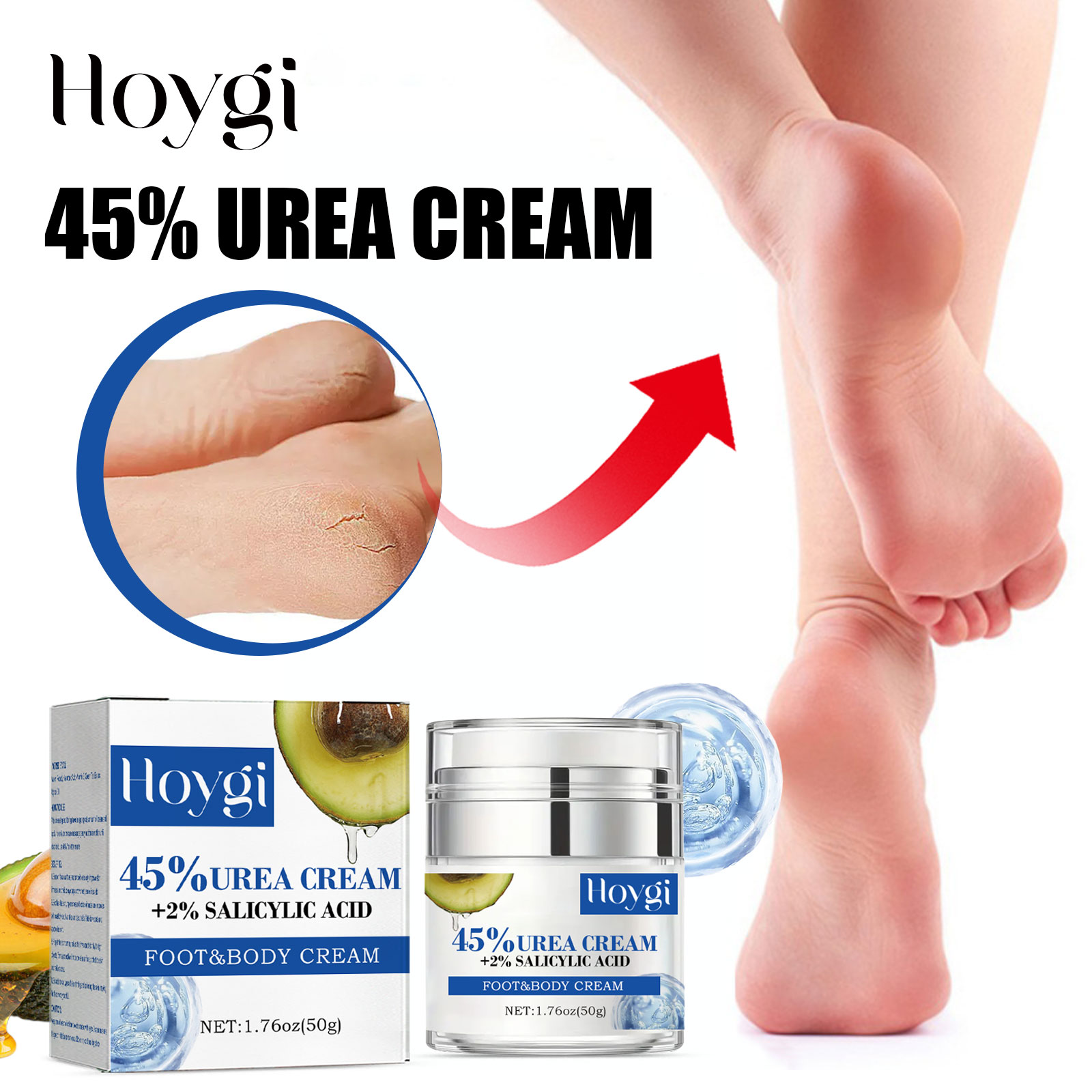 45% urea cream jar beside smooth leg imagery