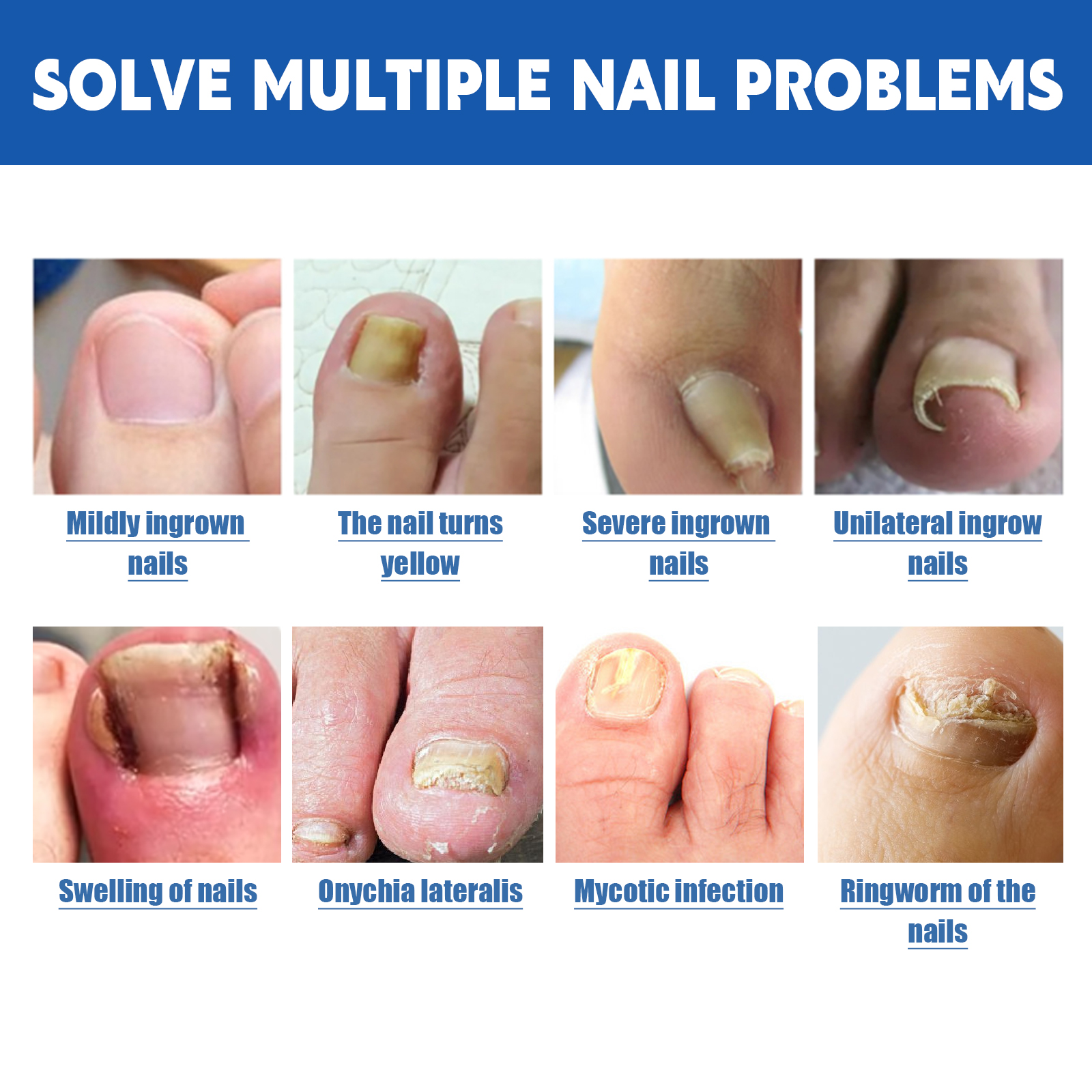 Graphic showing nail concerns the patches target