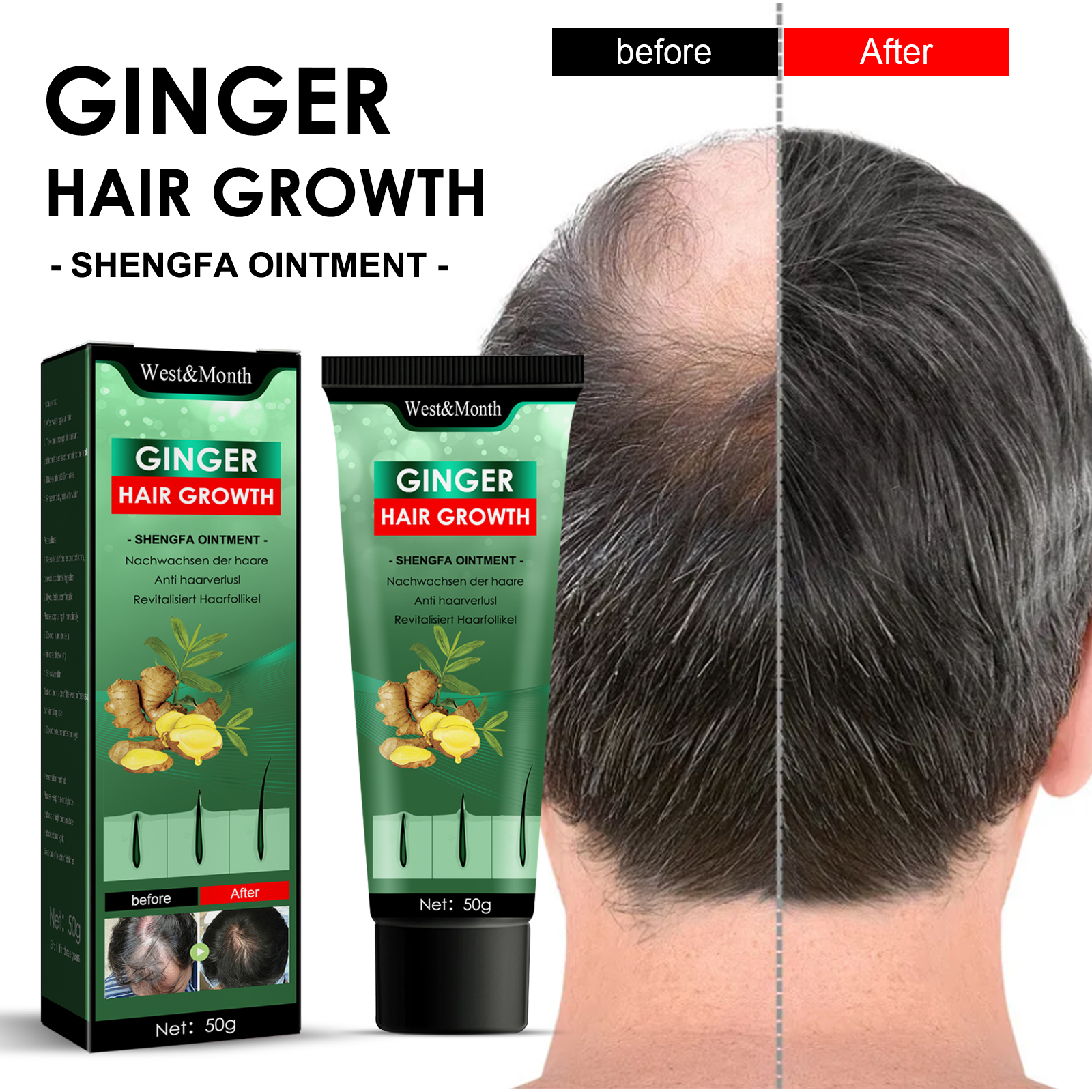 Ginger Hair Growth Ointment, Moisturize And Thicken Hair, Re