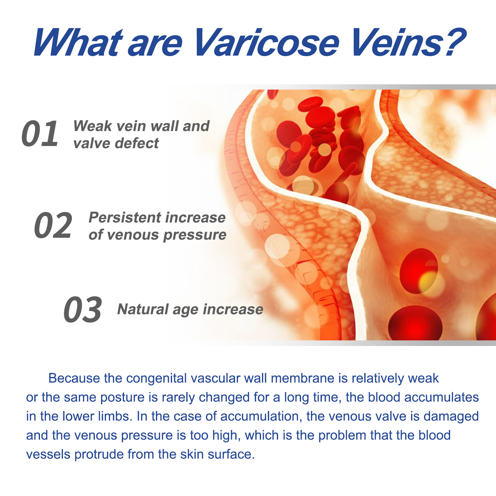 Educational graphic about leg veins and daily skin care