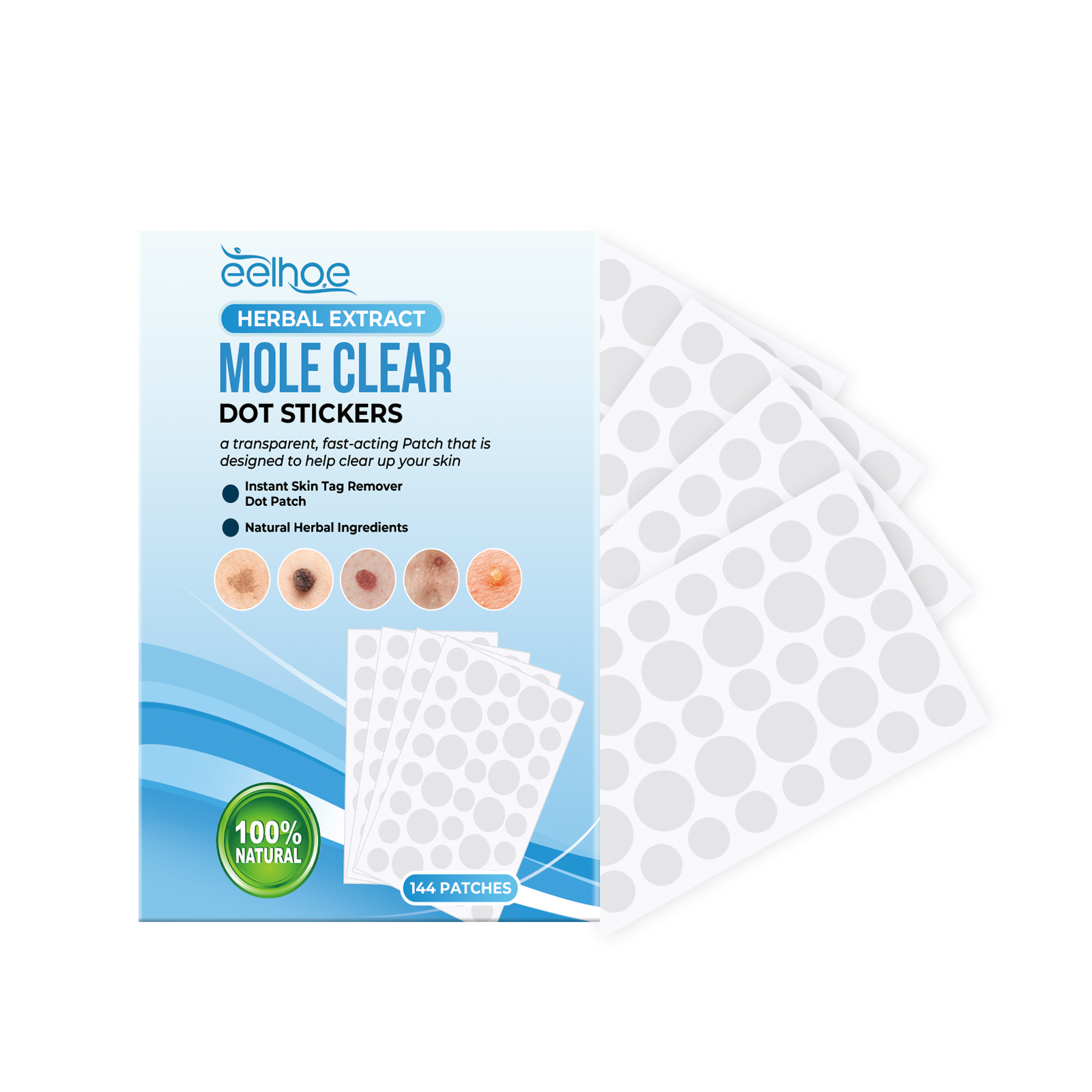 Mole Removal On Skin Mole Mole Mole Mole Mole Mole Mole Mole