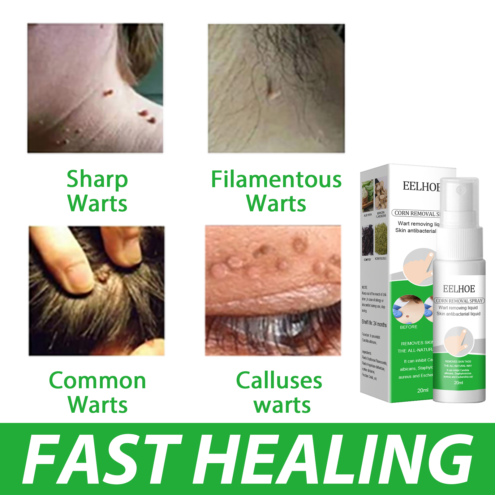 Green and white carton with wart care illustrations