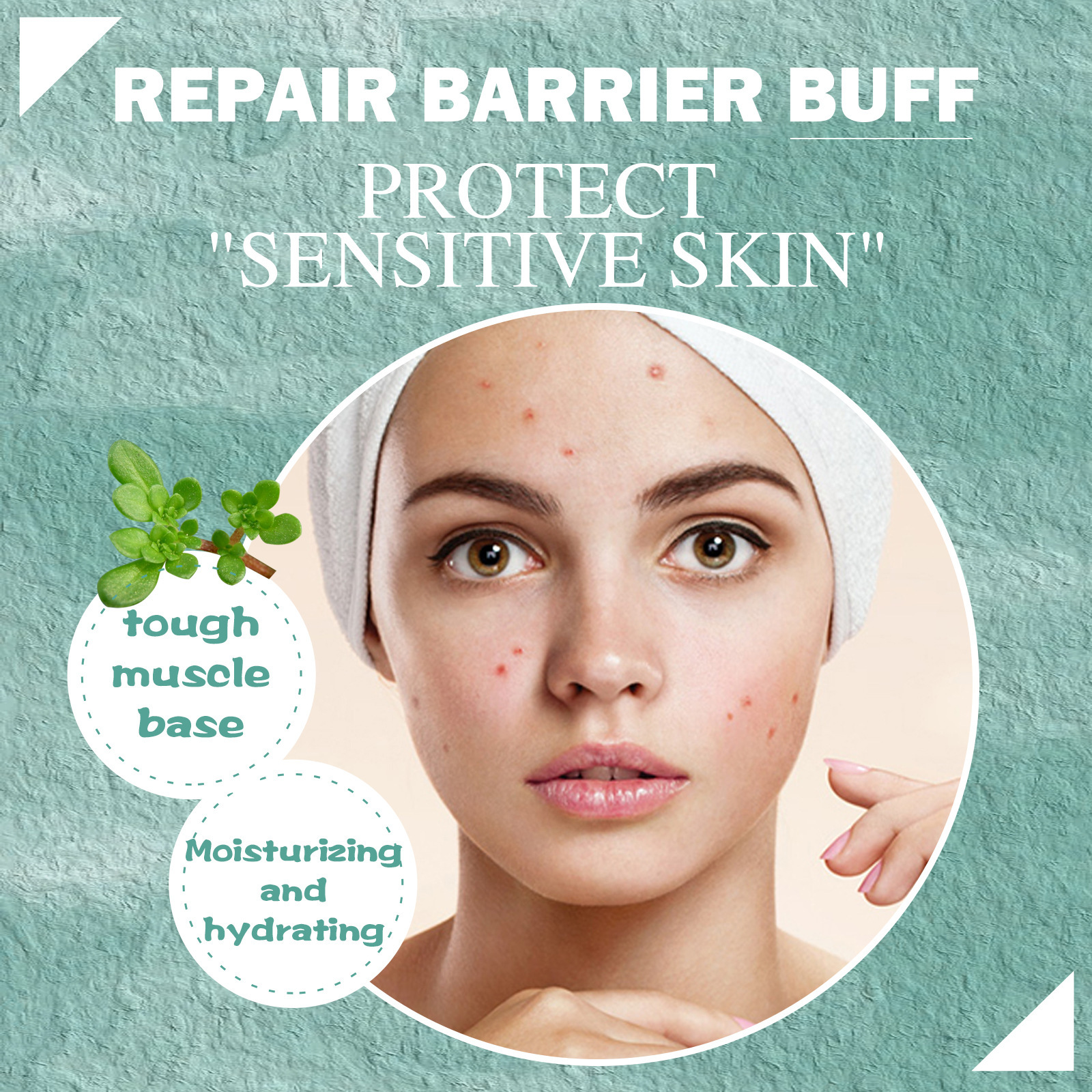 Sensitive skin acne treatment with barrier care claims