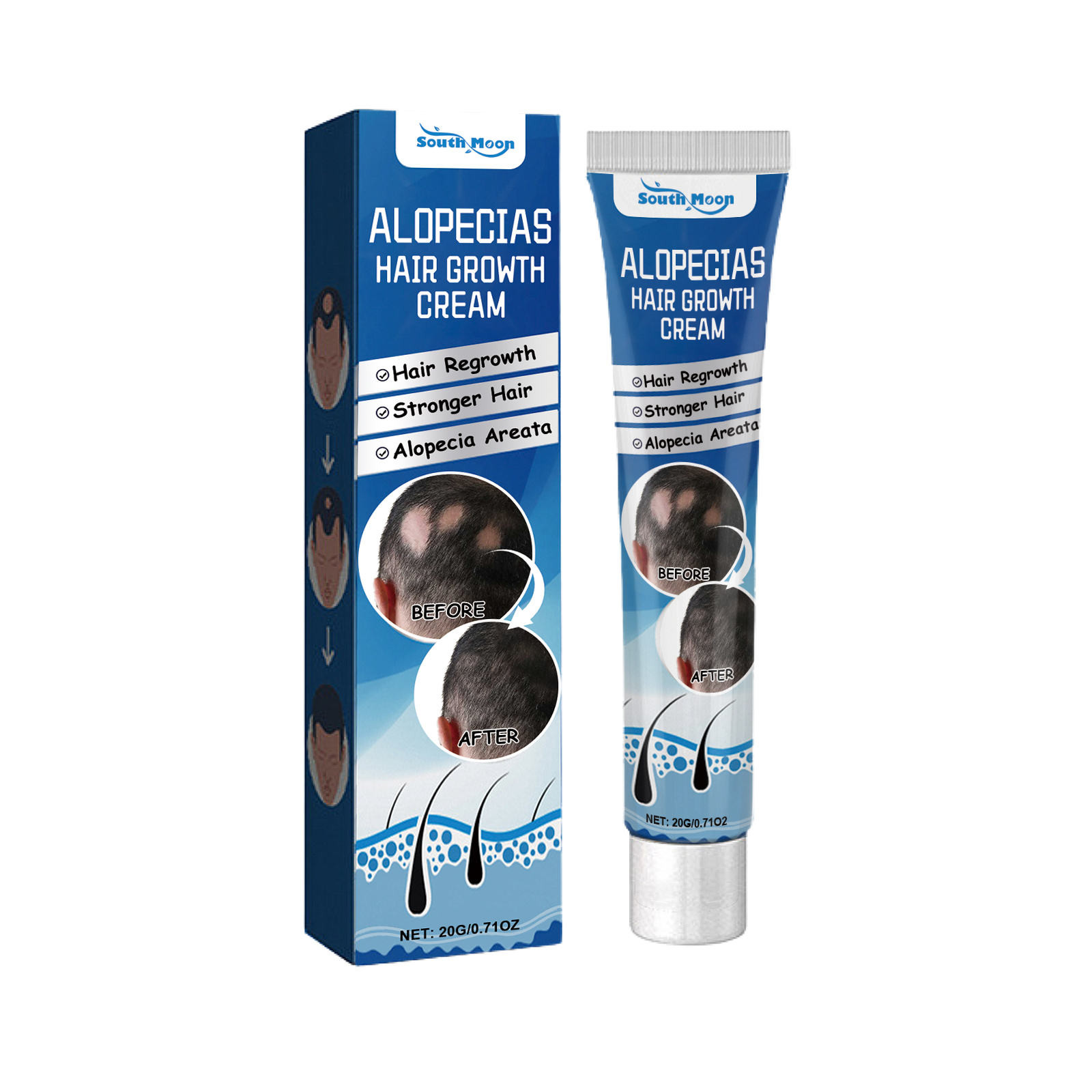 Alopecias Hair Growth Cream, Protect Hair Follicles Strong M