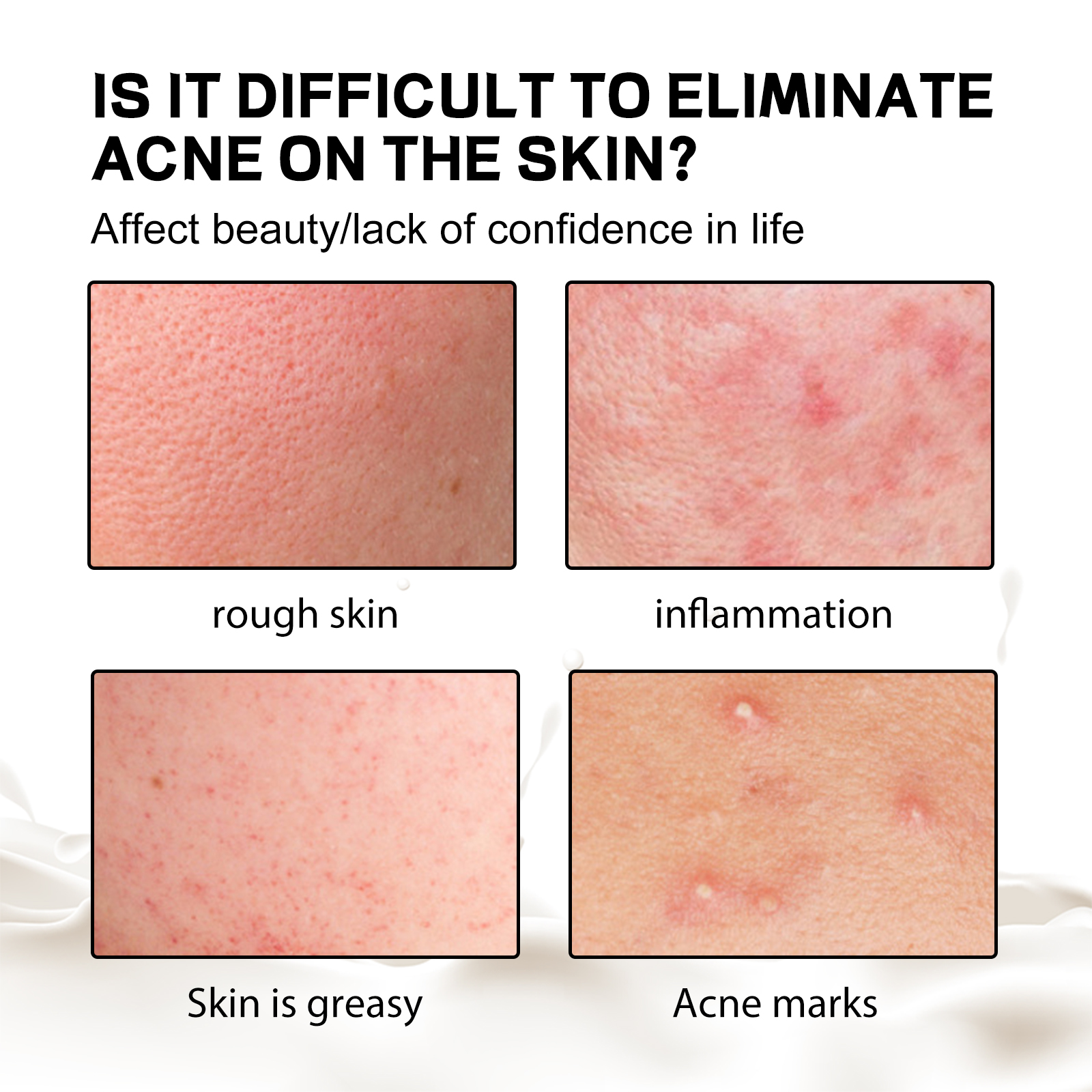 Close-ups showing rough oily and blemish-marked back skin