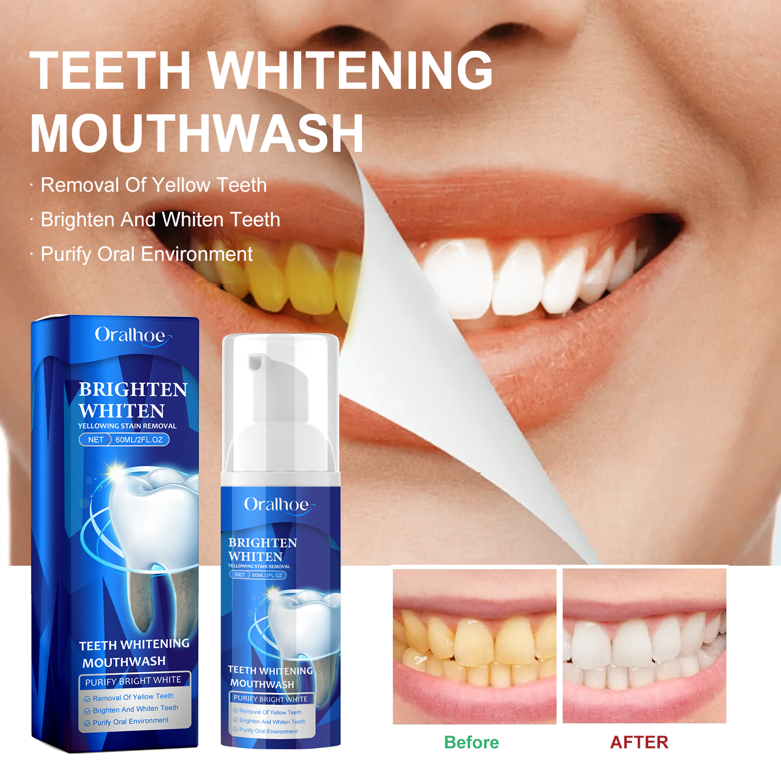 Whitening mouthwash beside brighter-looking smile comparison