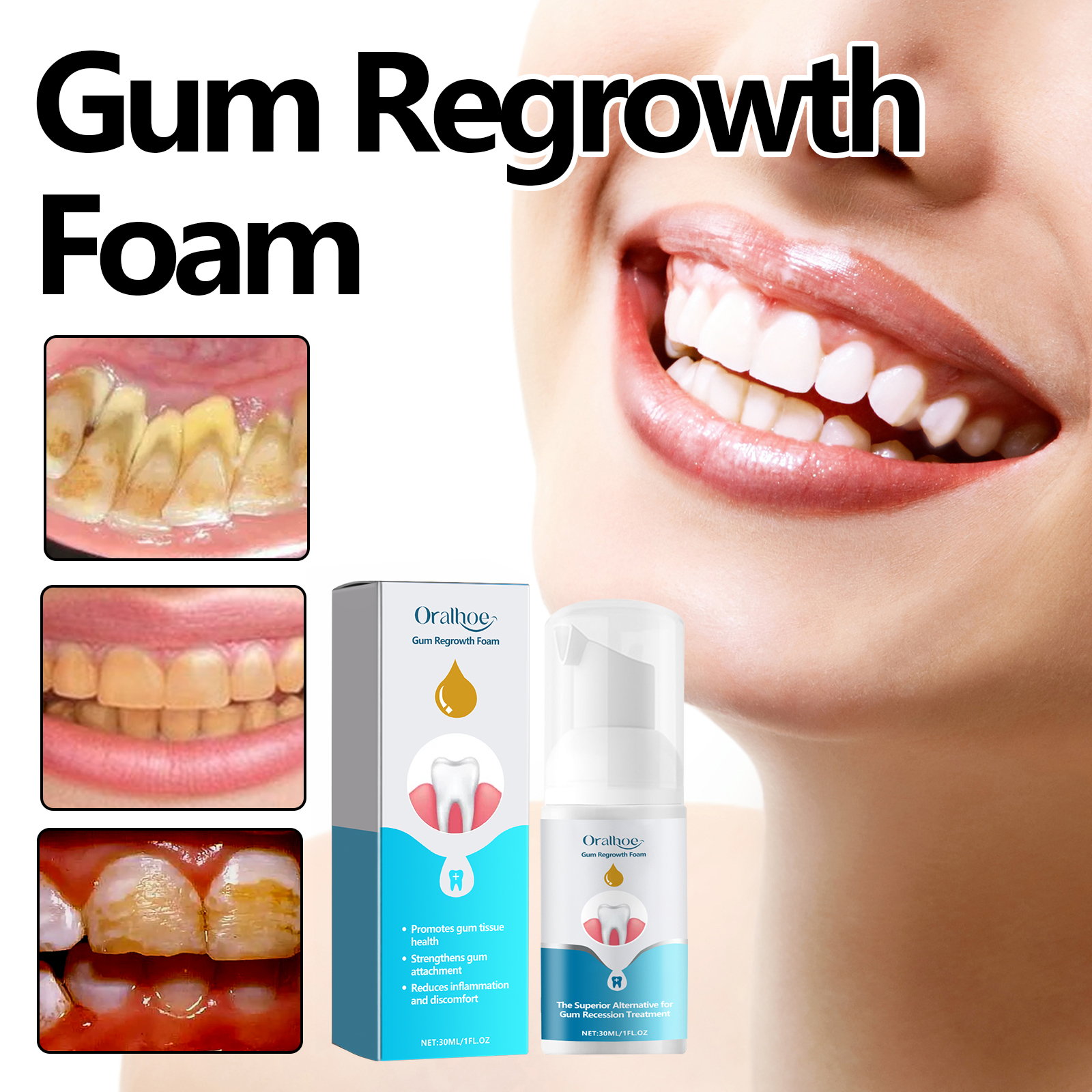 Gum care foam beside cleaner-looking smile imagery