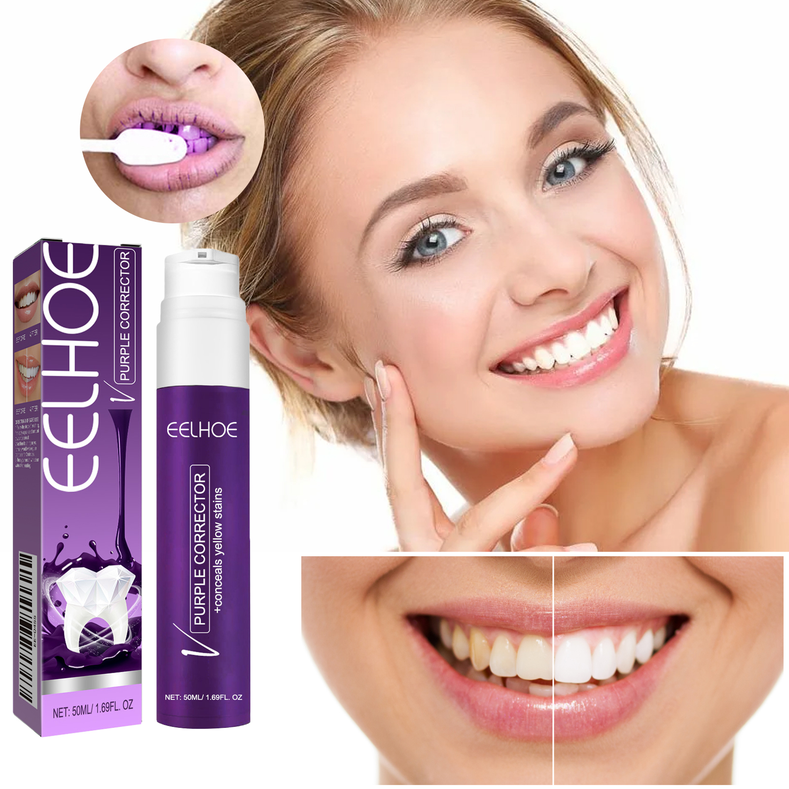 Purple gel shown during a smile brightening routine