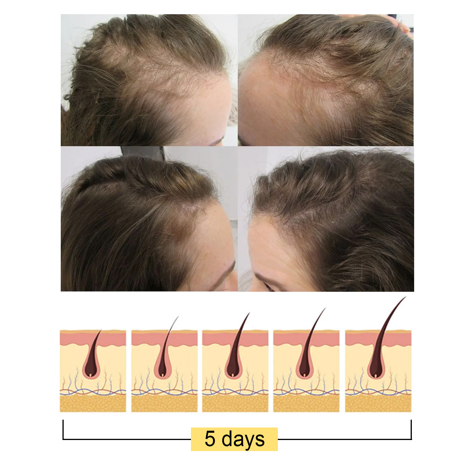 Before-and-after hairline imagery showing fuller-looking styling