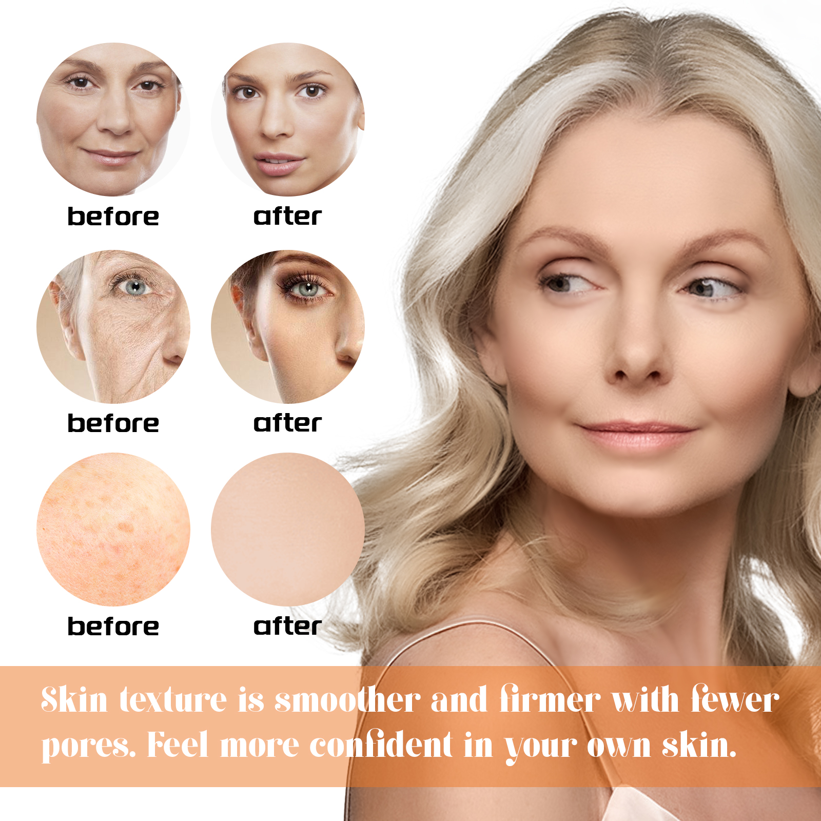 Facial before and after comparison showing smoother-looking skin
