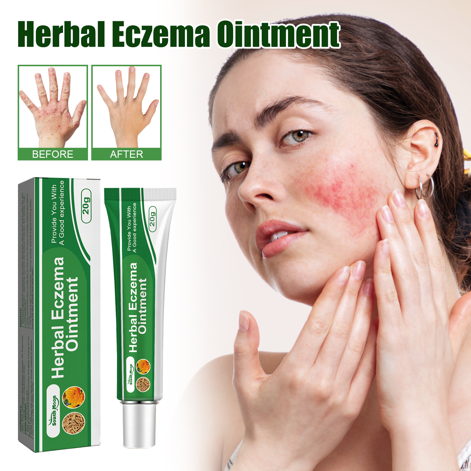 Herbal Eczema Ointment, Relieve Hand And Foot Moss Skin Redn