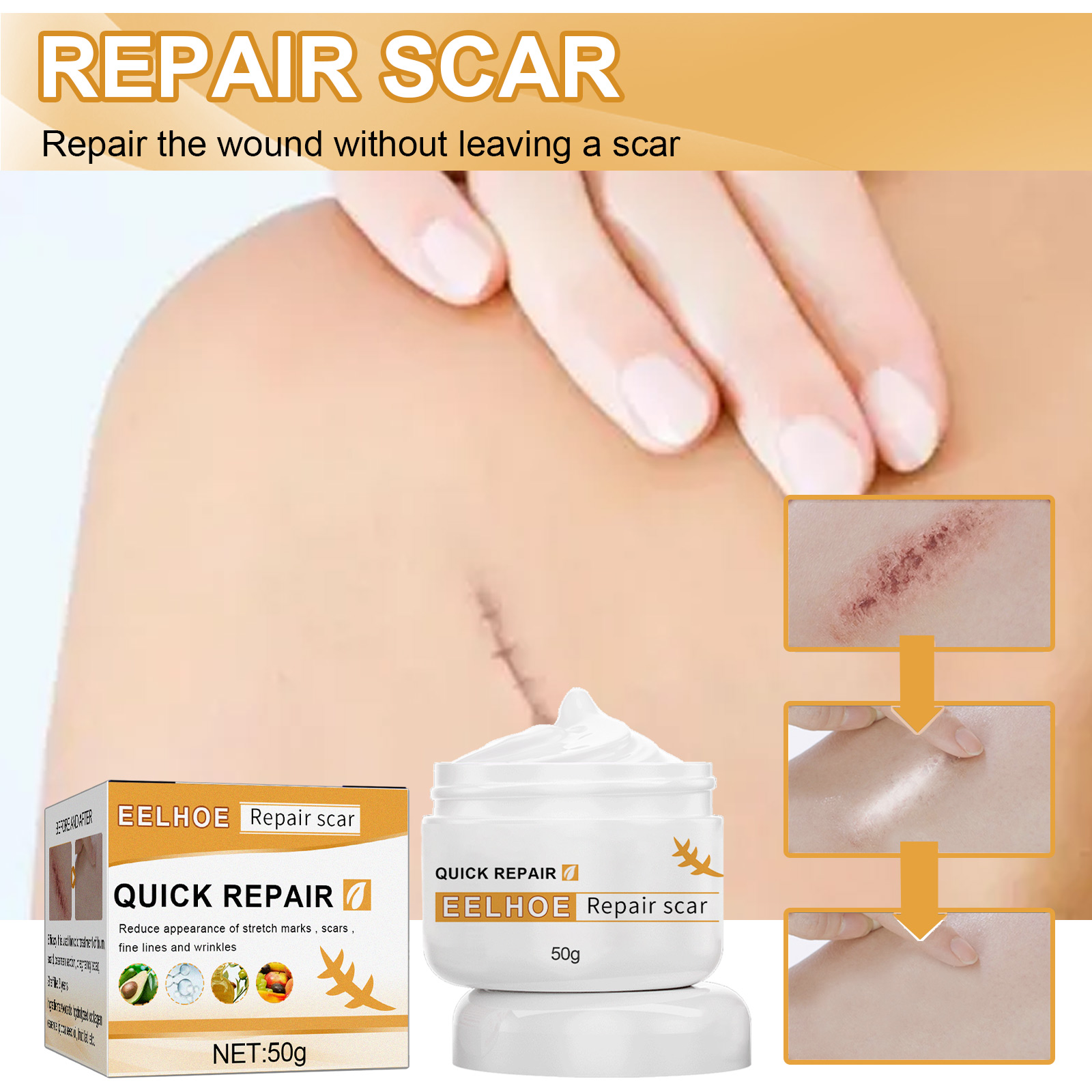 EELHOE Desalting Skin Scar Cream, Skin Burn Scalding Surgica