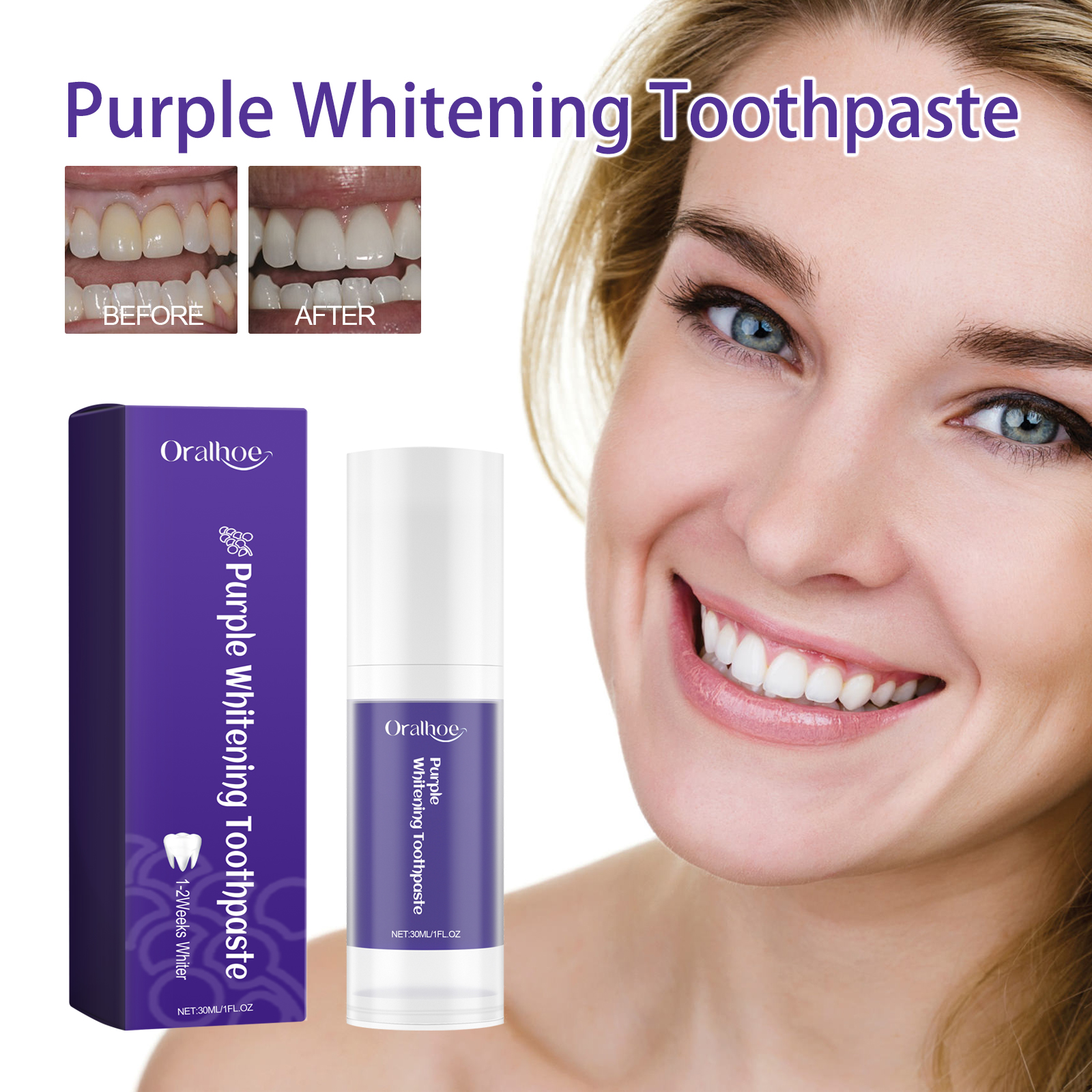 Purple toothpaste beside brighter-looking before-and-after smiles