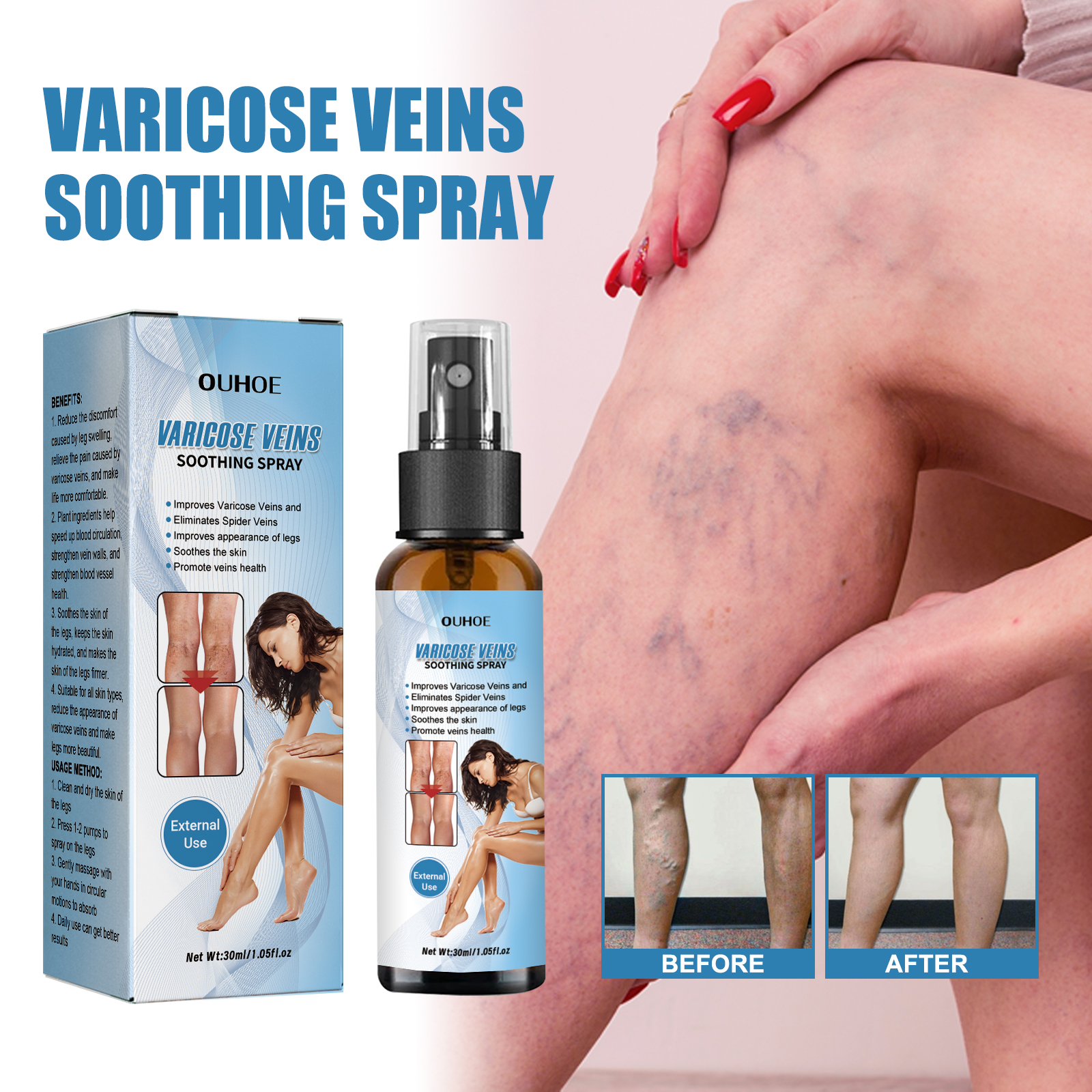 Vein Treatment Spray, Relieve Leg Soreness And Swelling Repa