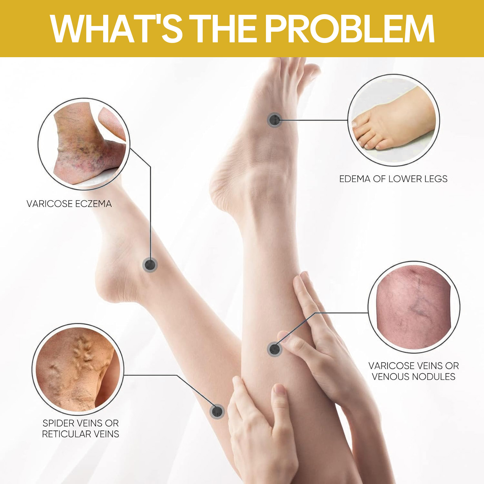 Illustration showing common lower-leg skin concerns