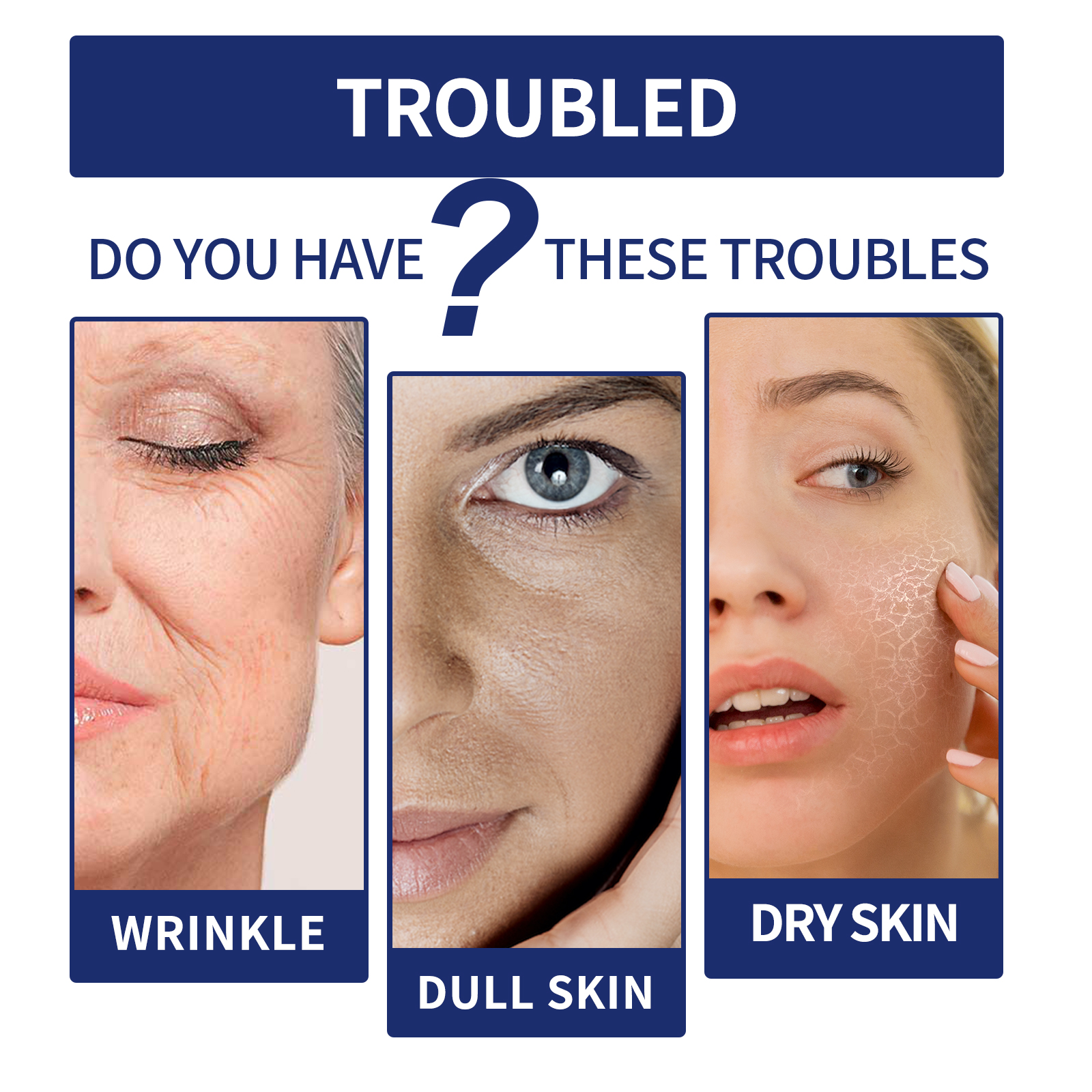 Under-eye concerns shown as wrinkles dullness and dryness