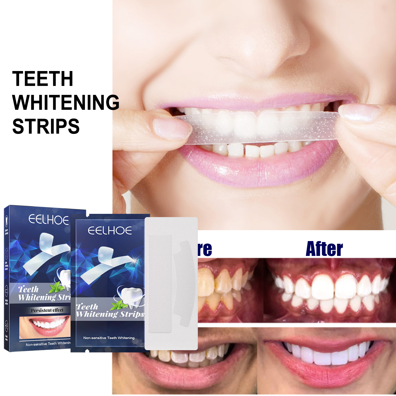 Adhesive strip positioned across upper teeth