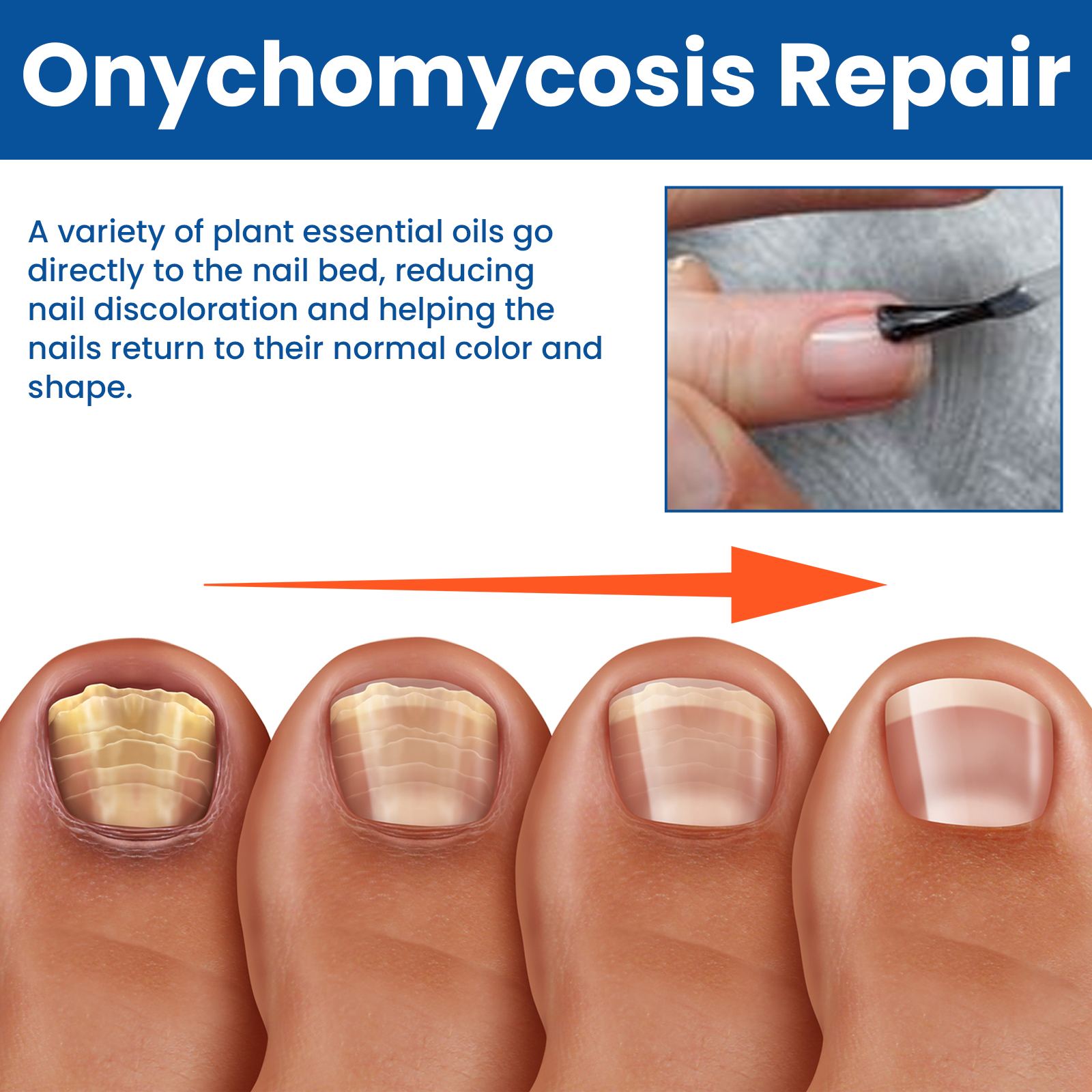 Boxed amber nail treatment presentation with tools