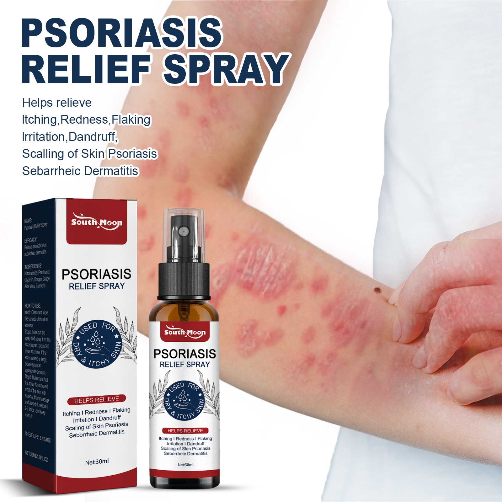 Psoriasis Relief Spray, Relieve Skin, Hands And Feet Redness