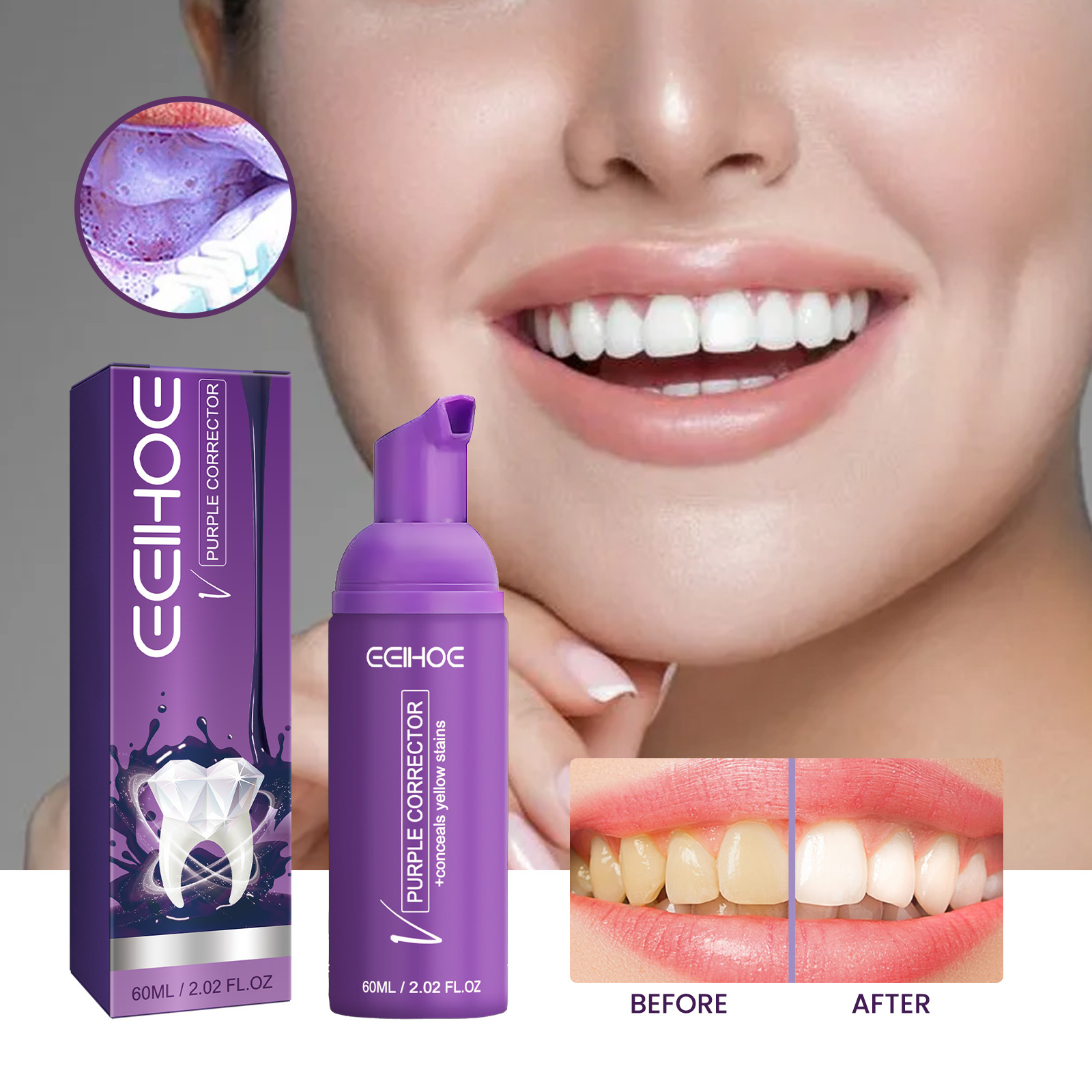 Smile comparison showing yellow-looking and brighter-looking teeth