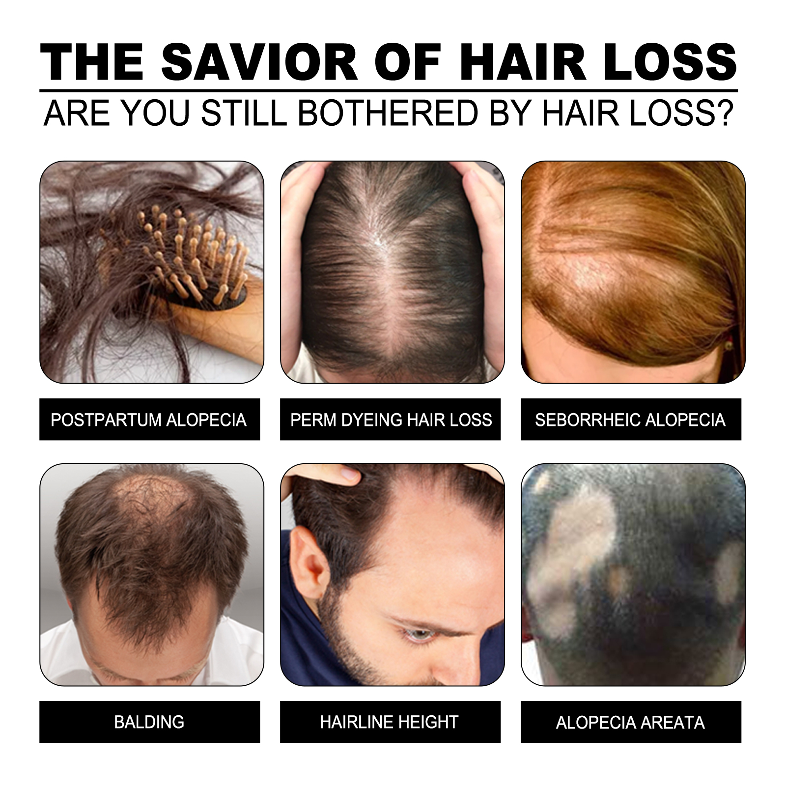 Hair thinning concerns shown beside ginger scalp care packaging
