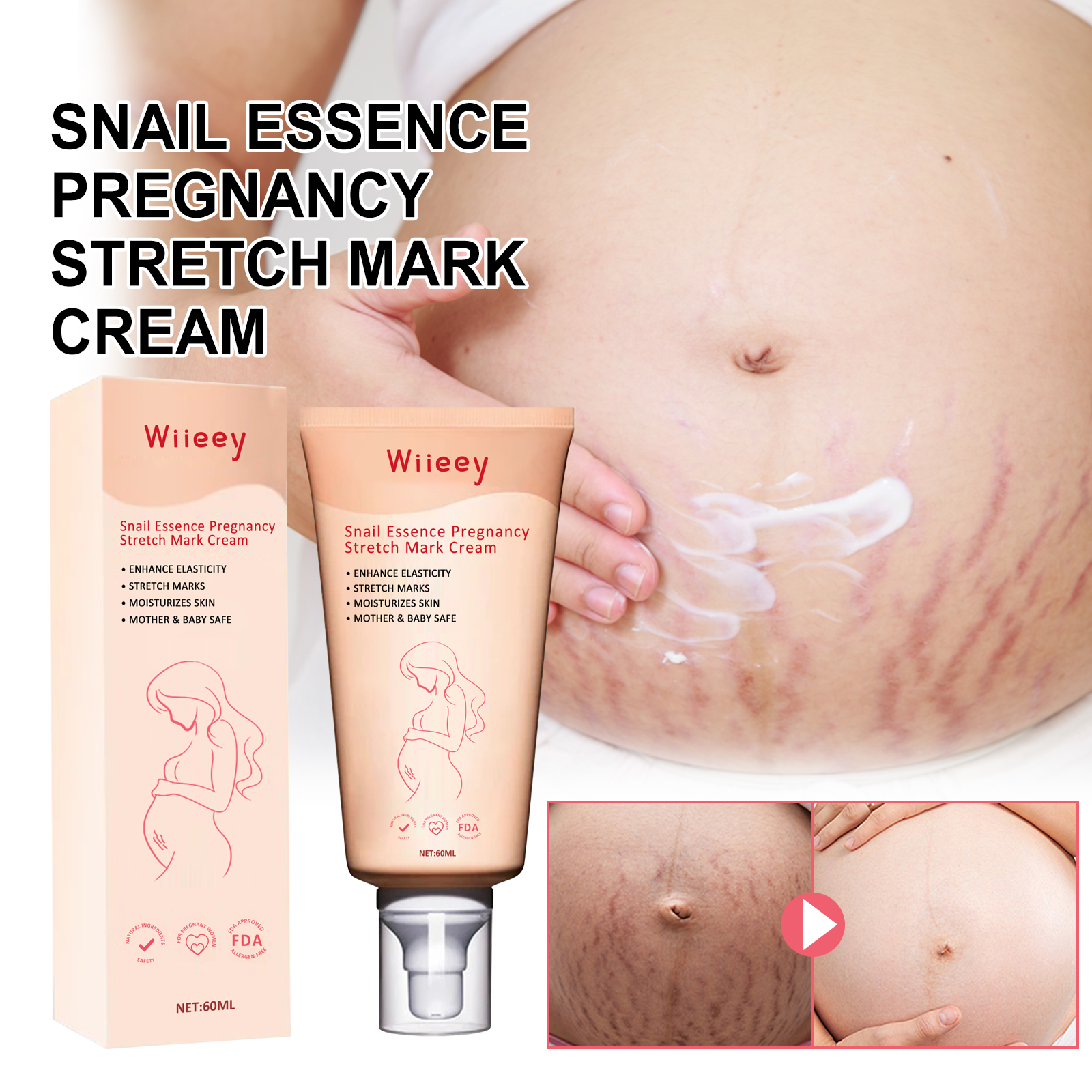 Pregnant abdomen receiving gentle moisturizing cream application