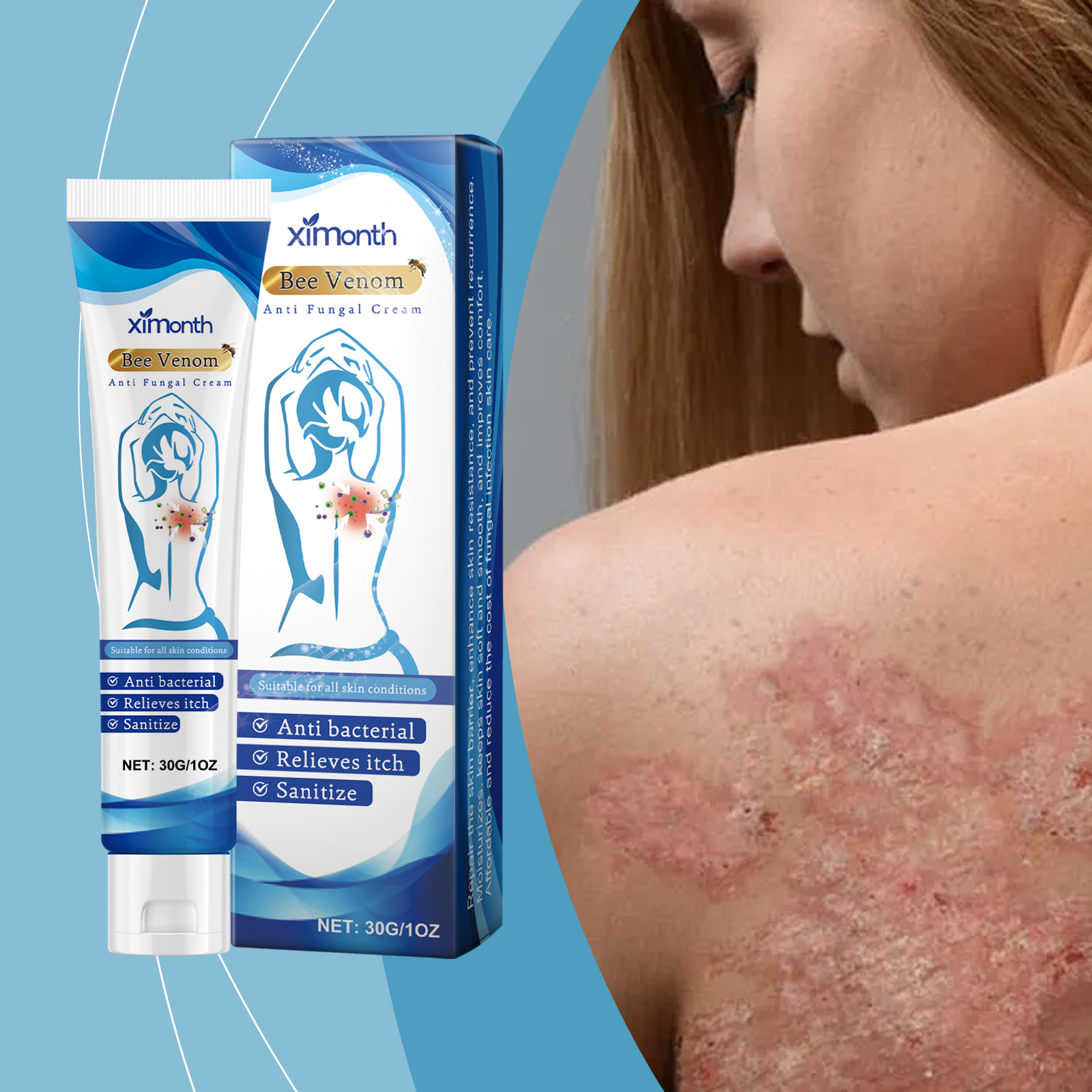 Compact cream package shown beside irritated skin