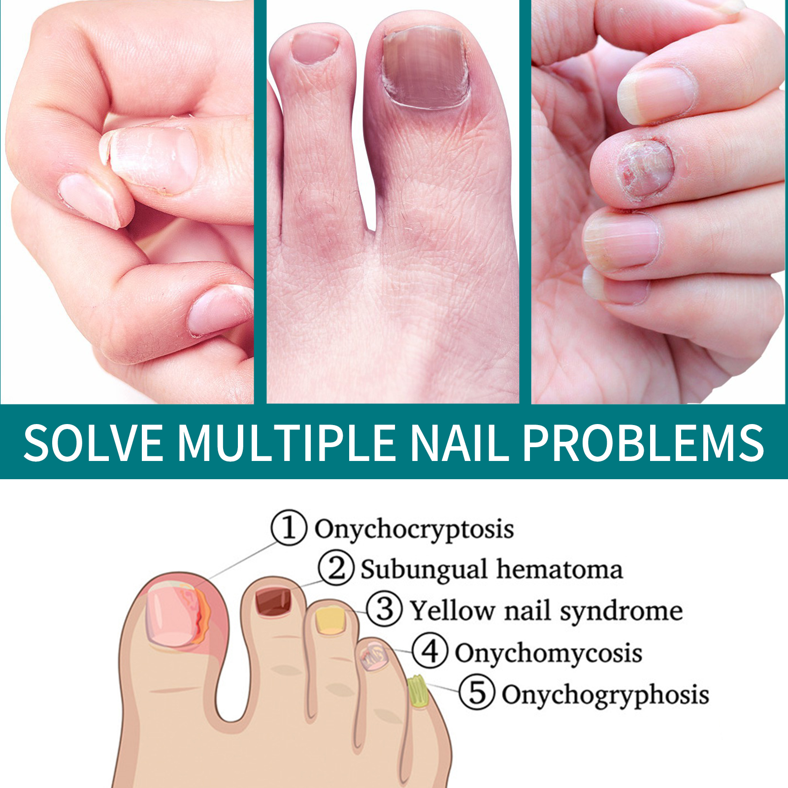 Nail condition illustrations beside repair patch packaging