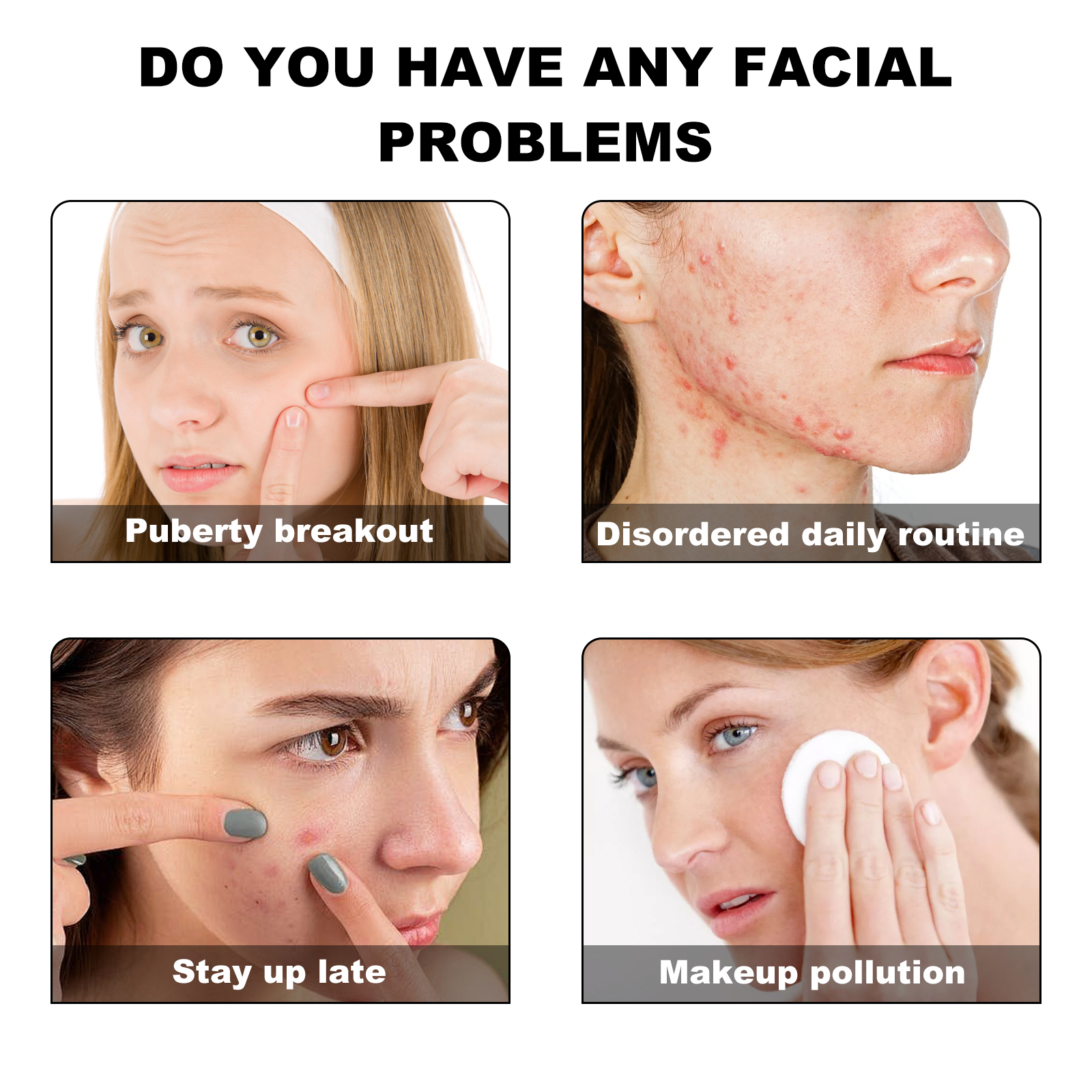 Acne patch care for everyday breakout situations