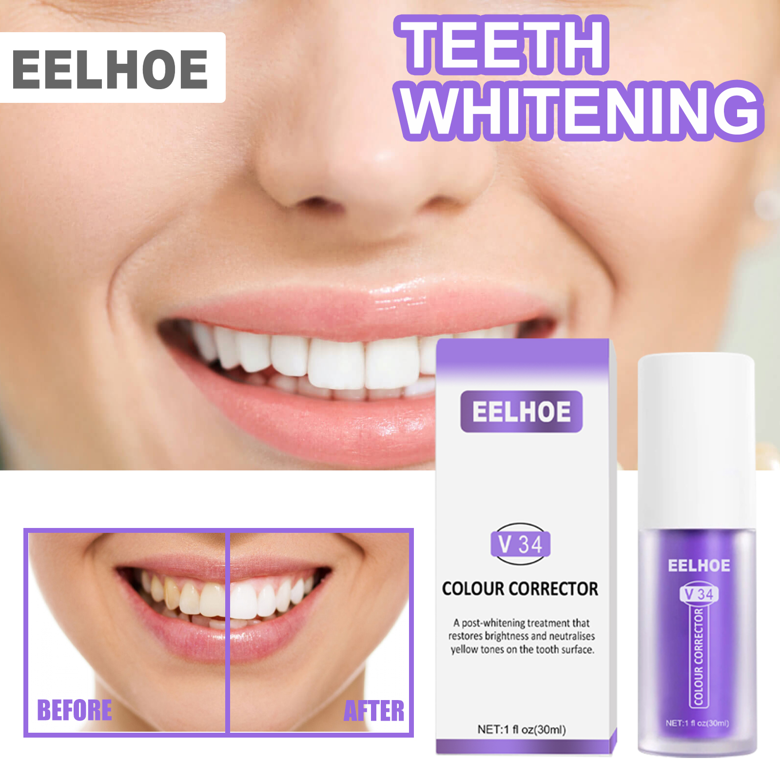 Smile comparison showing cosmetic brightness effect