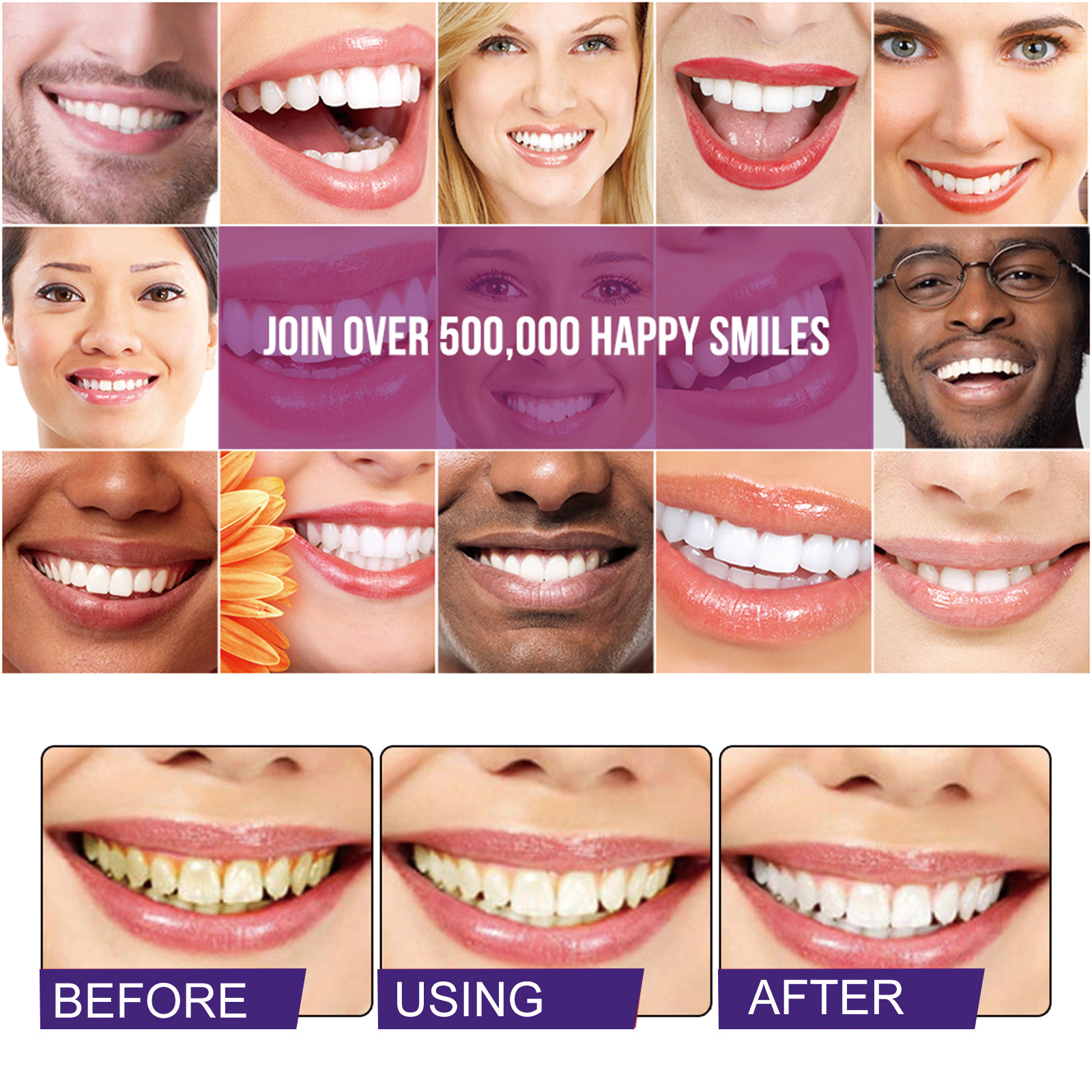 Smile panels showing dull to brighter-looking teeth