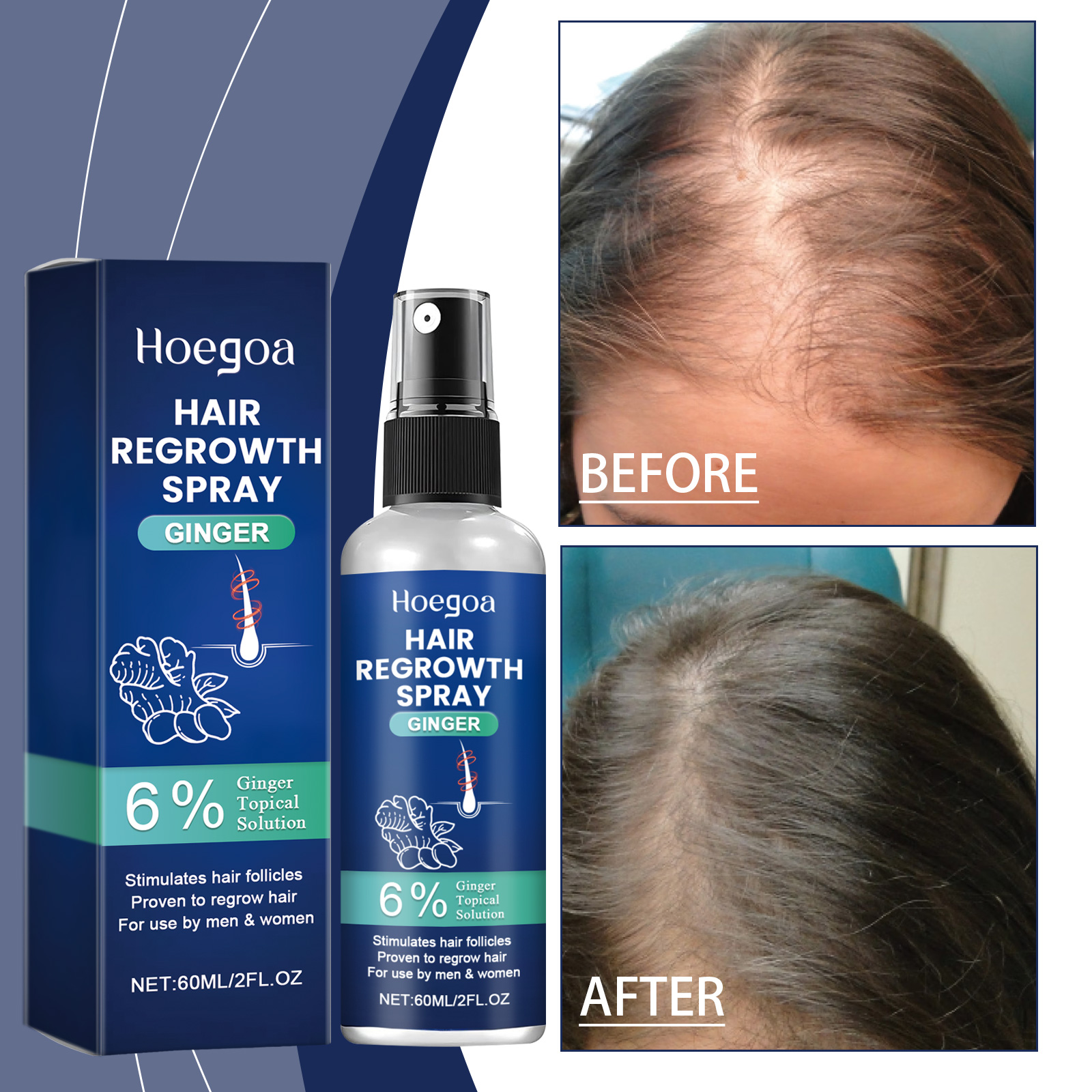 Hair regrowth spray beside fuller-looking hair imagery