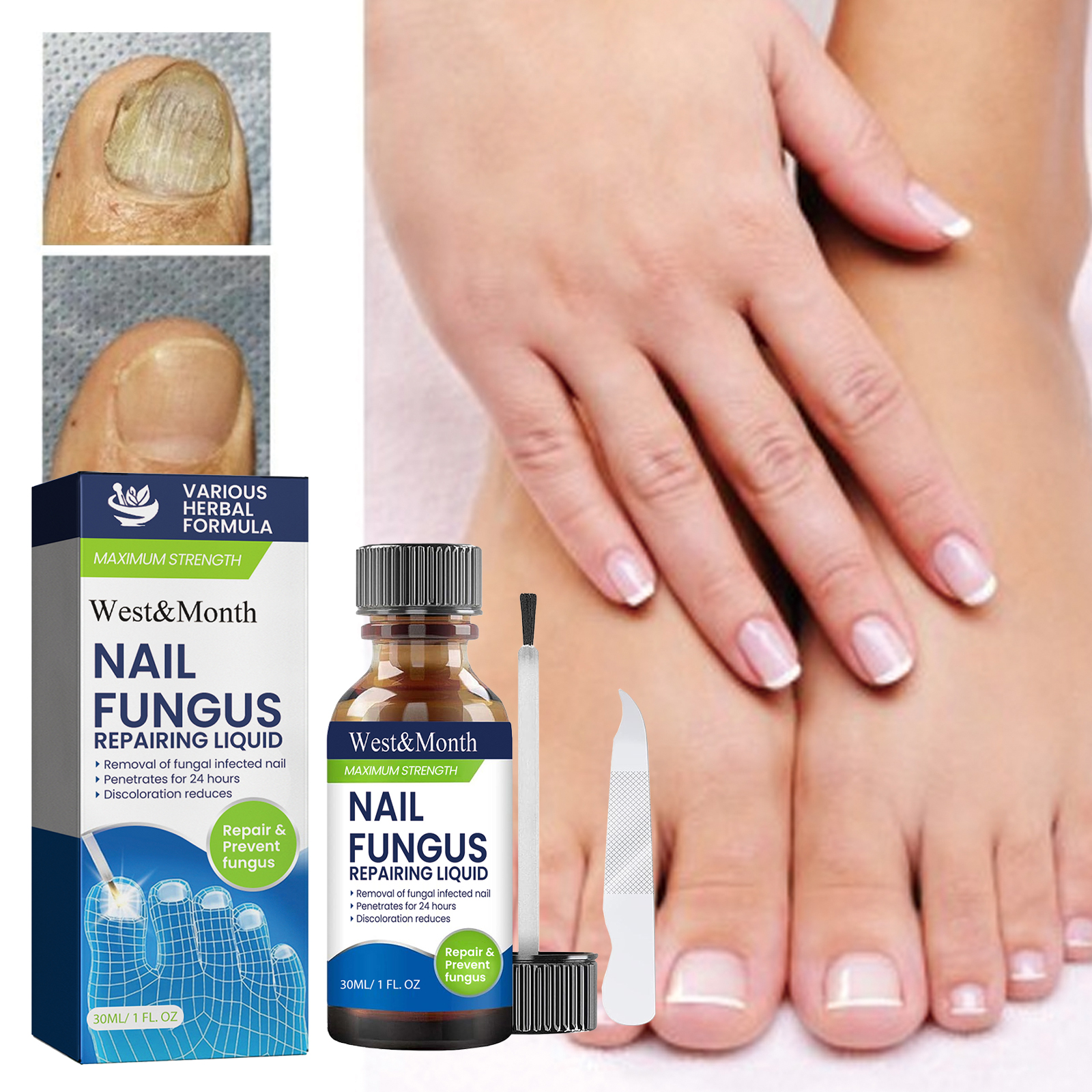 Complete nail care set beside hand and foot nails